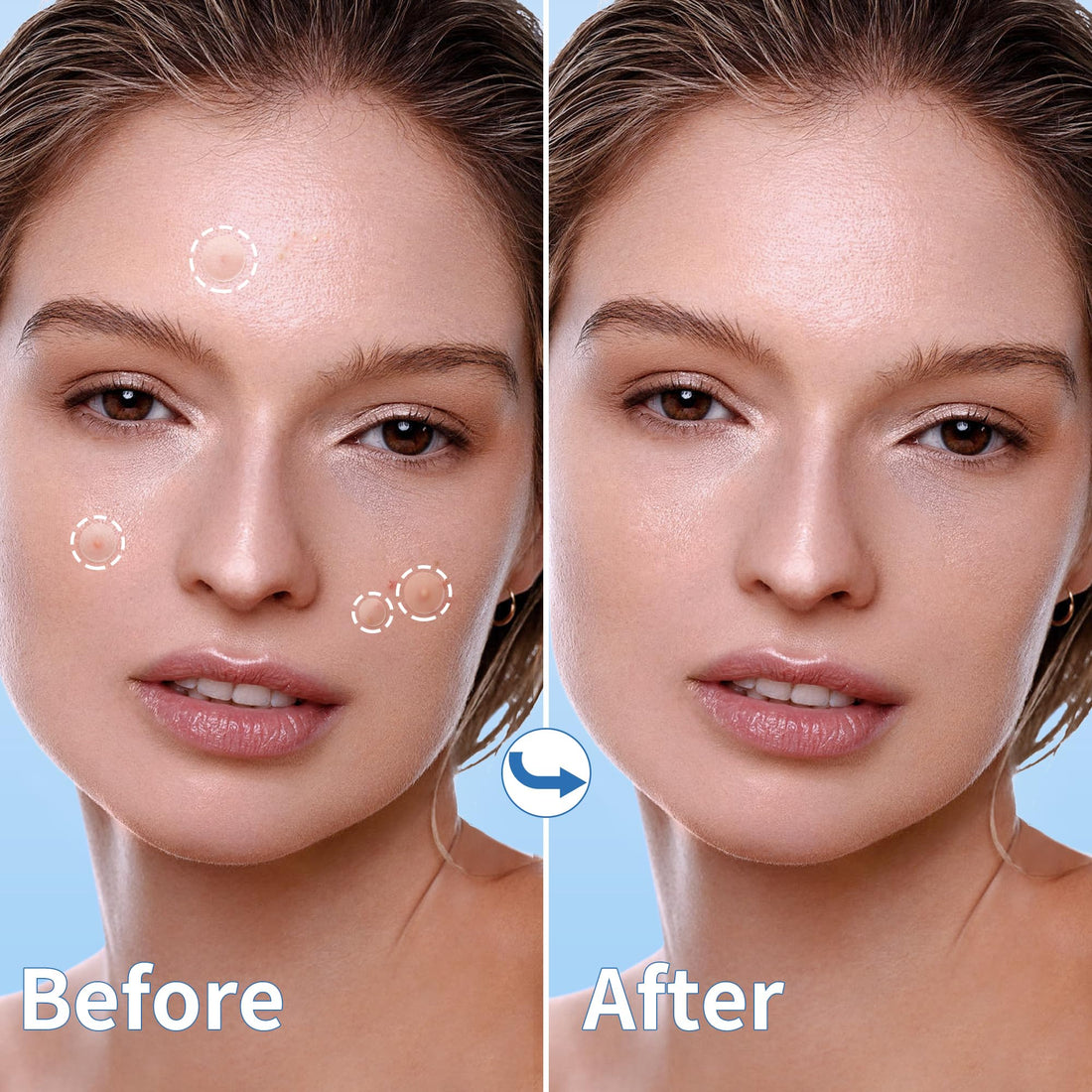 Daolyo Pimple Patches for Face, 3 Size 510 Counts Hydrocolloid Acne Patches for Covering Zits and Blemishes, Spot Stickers with Salicylic Acid, Tea Tree Oil & Calendula Oil(8mm,10mm,12mm)