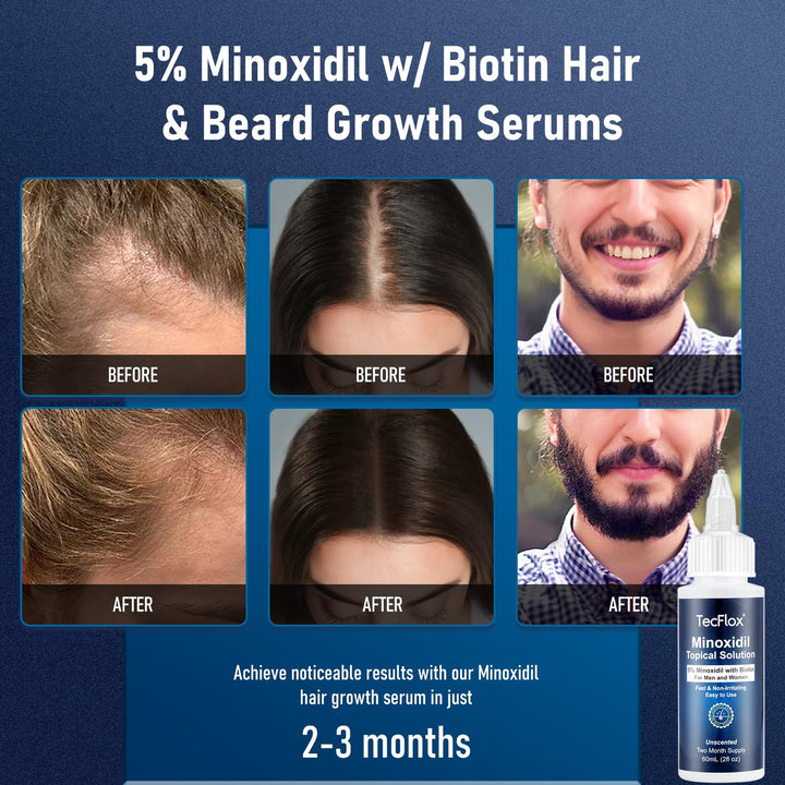 5% Minoxidil for Men & Women Hair with Biotin, Minoxidil for Men Beard,Tecflox Minoxidil Beard Growth Oil, Minoxidil Hair Growth Serum, 2-Pack, Total 4fl oz for 4 Months, Hair Growth Oil Unisex