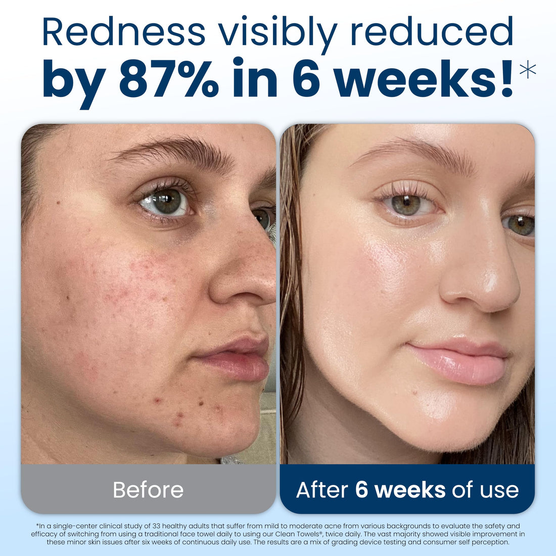 Clean Skin Club Clean Towels XL®, Travel Pack 100% USDA Biobased Disposable Face Towel, Eczema Association Accepted,Dry Wipes, TSA-Approved Travel Essential,10 ct per pack, 1 Pack, 10 Ct Total