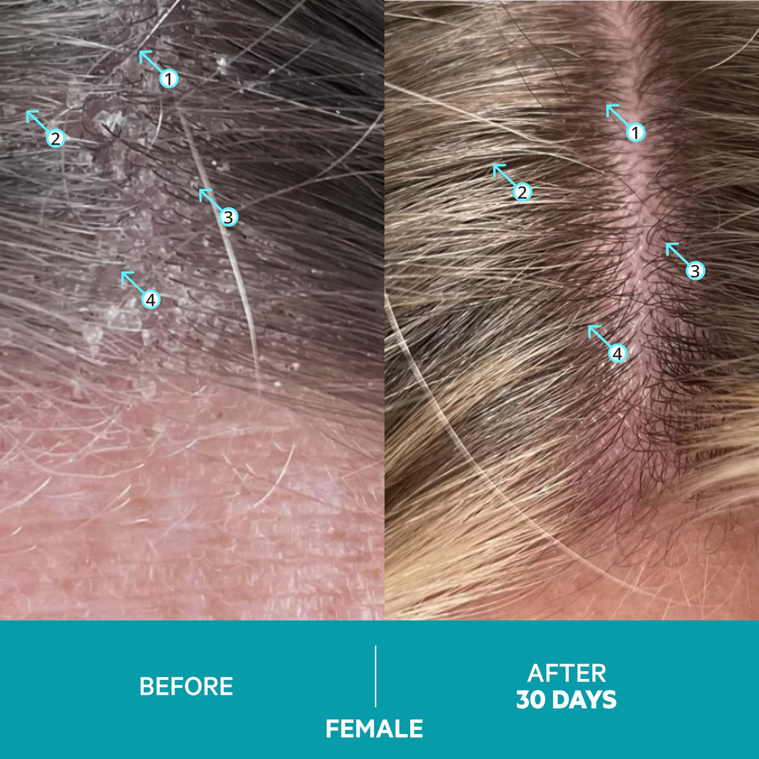 Dandrene Anti-Dandruff Conditioner