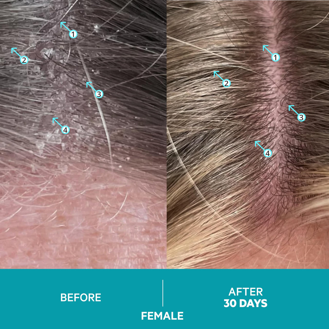 Dandrene Anti-Dandruff Conditioner