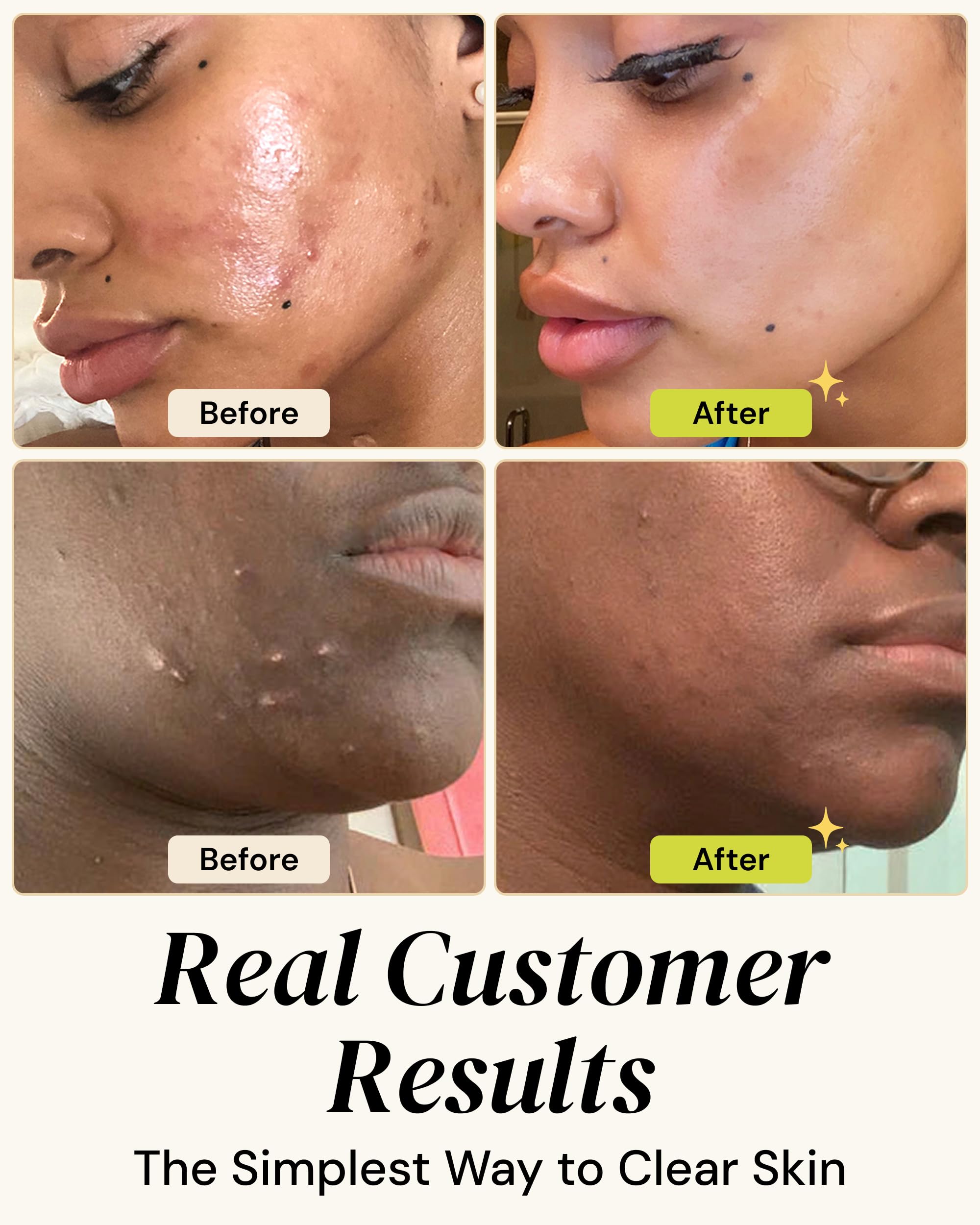 Gleamin Vitamin C Clay Mask for Dark Spots,10-Minutes Turmeric Clay Face Mask Skin Care, Deep Cleansing Pores - Facial Improves Uneven Tone, Post-Blemish, Visibly Brighten, Scarring & Texture - 2.5 Oz