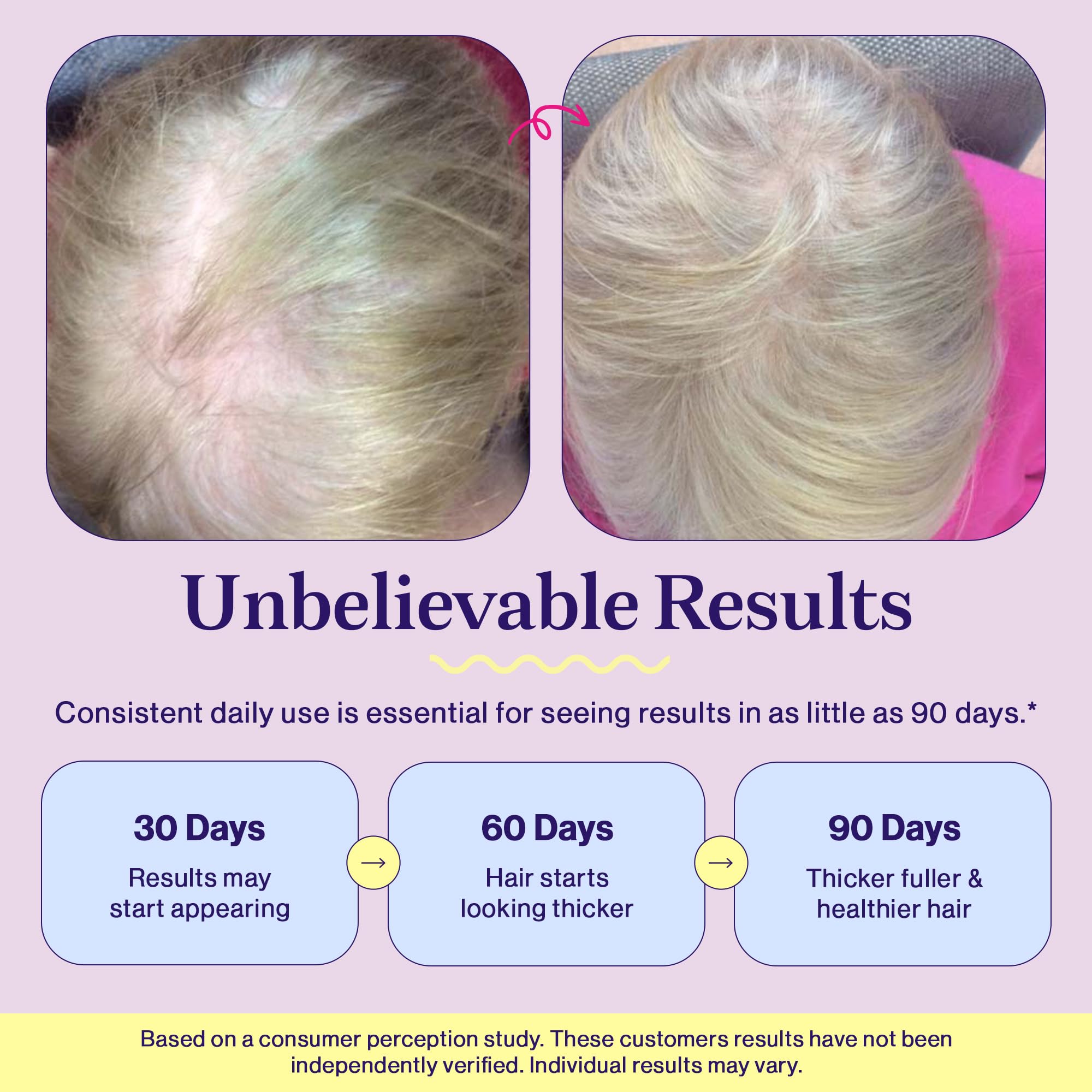 Fuel Multi Collagen Protein Powder - Resveratrol Extract, Multi Collagen Peptides - Hydrolyzed Collagen for Women with Hyaluronic Acid & Biotin Collagen Powder Promote Skin, Hair & Nail French Vanila