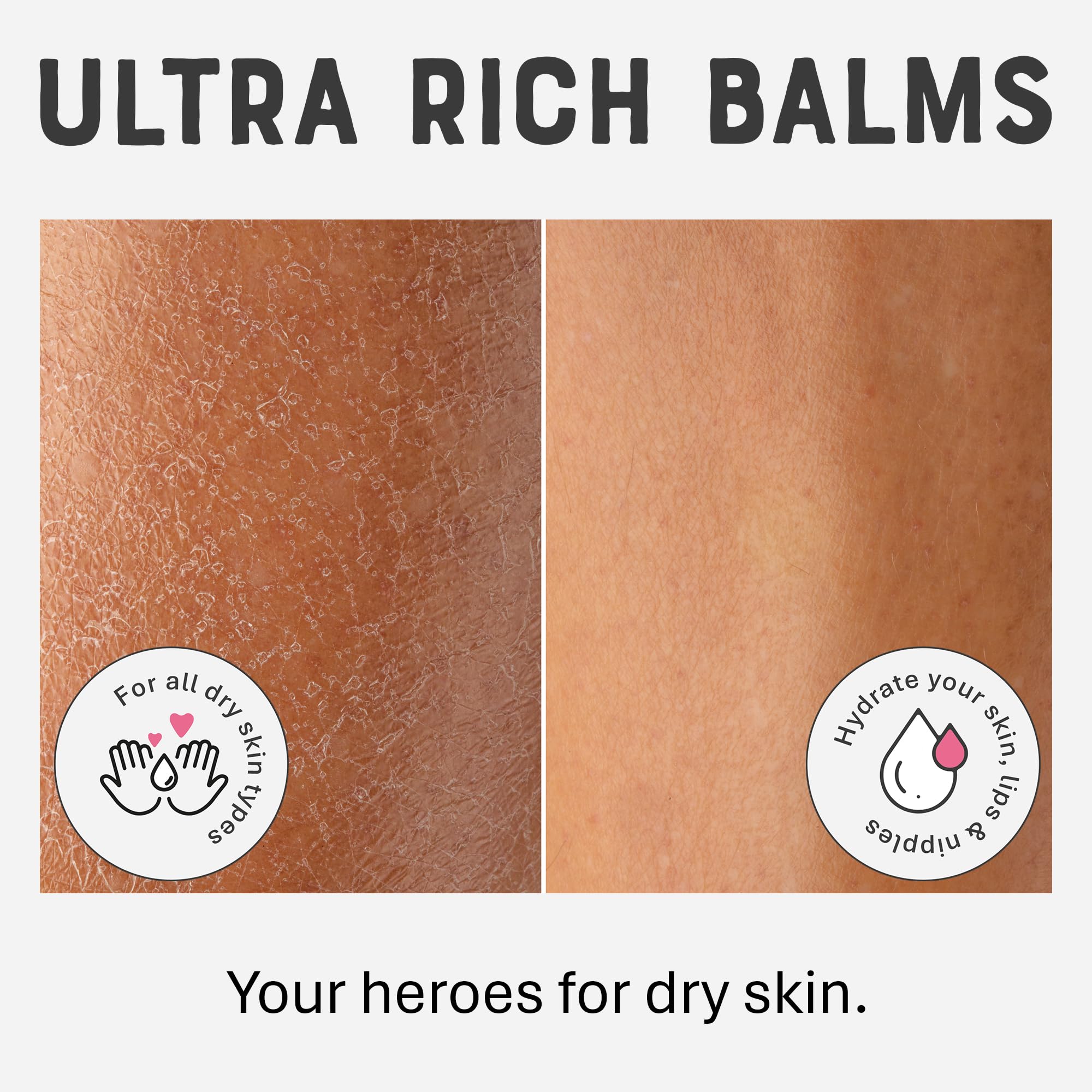 DR. LIPP Dry Skin Heroes [BFF ultra rich Balm 30ml & Original Nipple Balm 8ml] – 14-in-TWO Multi-Use Balms for Lips, Nipples & More – 100% Natural Coconut Oil & Lanolin – Fragrance & Cruelty Free
