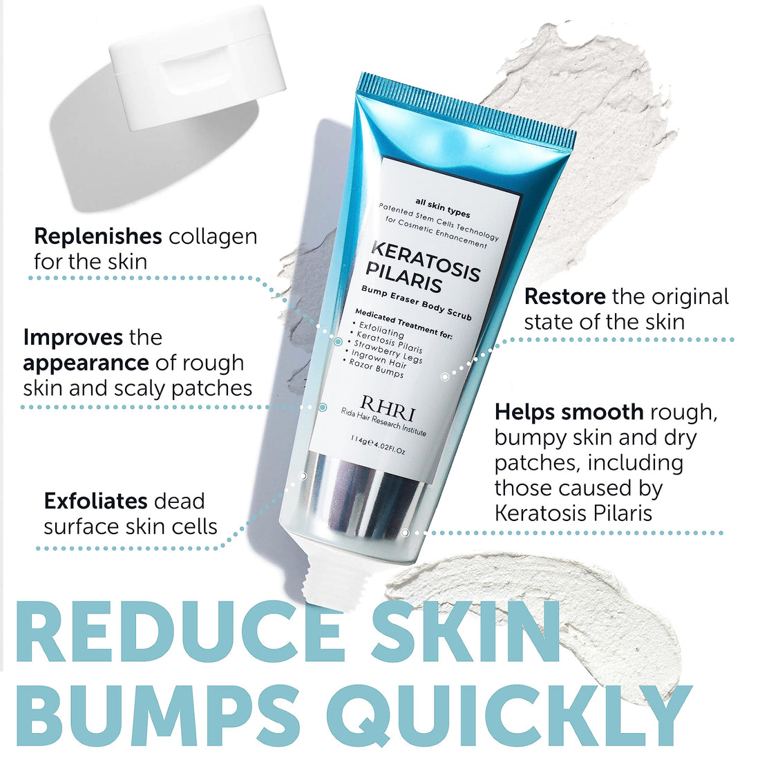KP Bump Eraser Body Scrub, Keratosis Pilaris Treatment, Strawberry Legs Treatment for Women, Bump Eraser Body Scrub