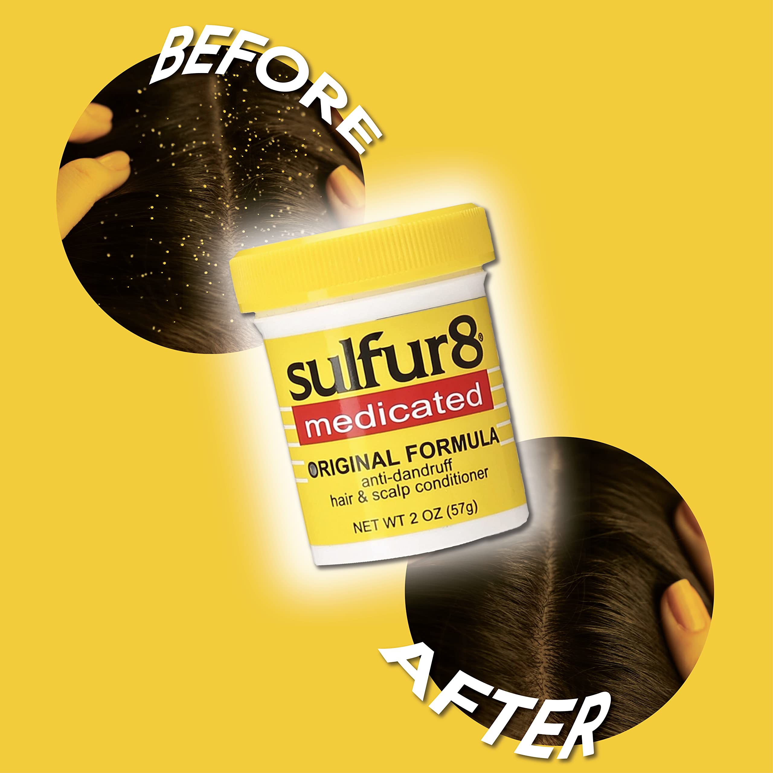 Sulfur 8 Medicated Original Formula Anti-Dandruff Hair and Scalp Conditioner, 2 Oz (Pack of 2)