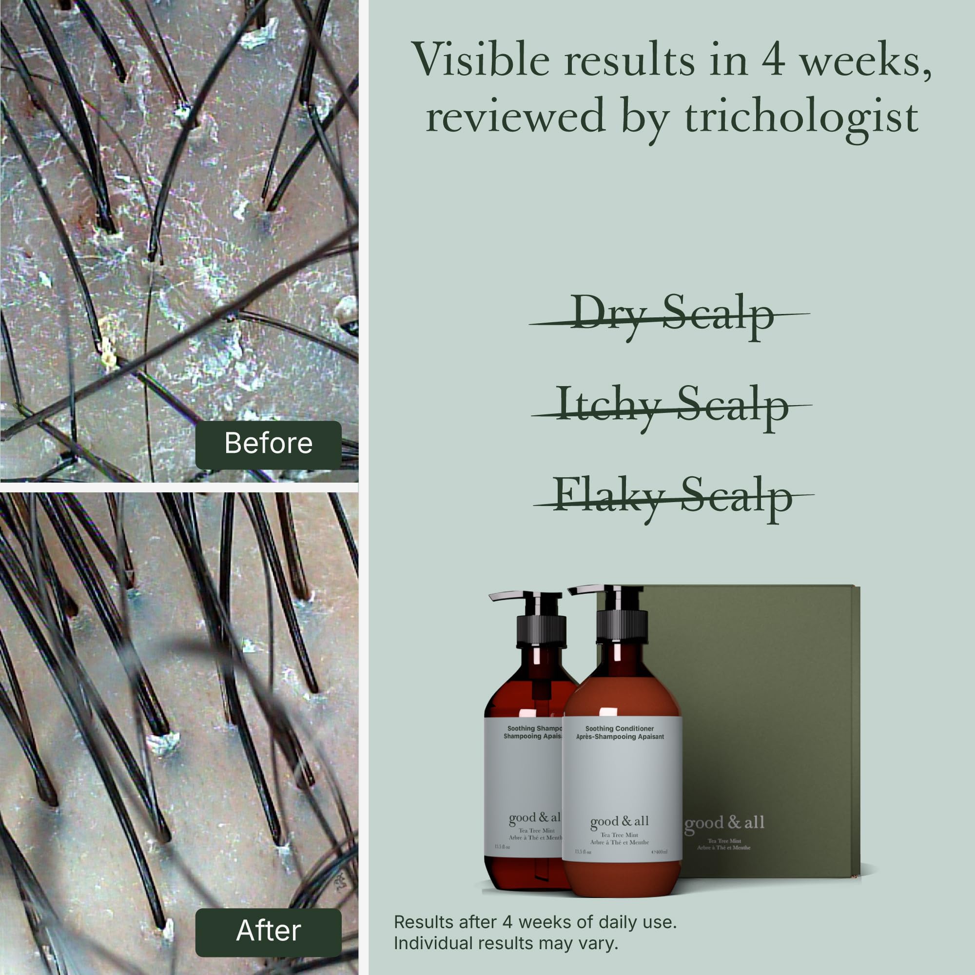 Good&All Tea Tree Shampoo and Conditioner Set for Dry Itchy Scalp with Peppermint - Sodium Lauryl Sulfate/Sulphate, Silicone, Paraben, Fragrance Free - 13.5 fl oz