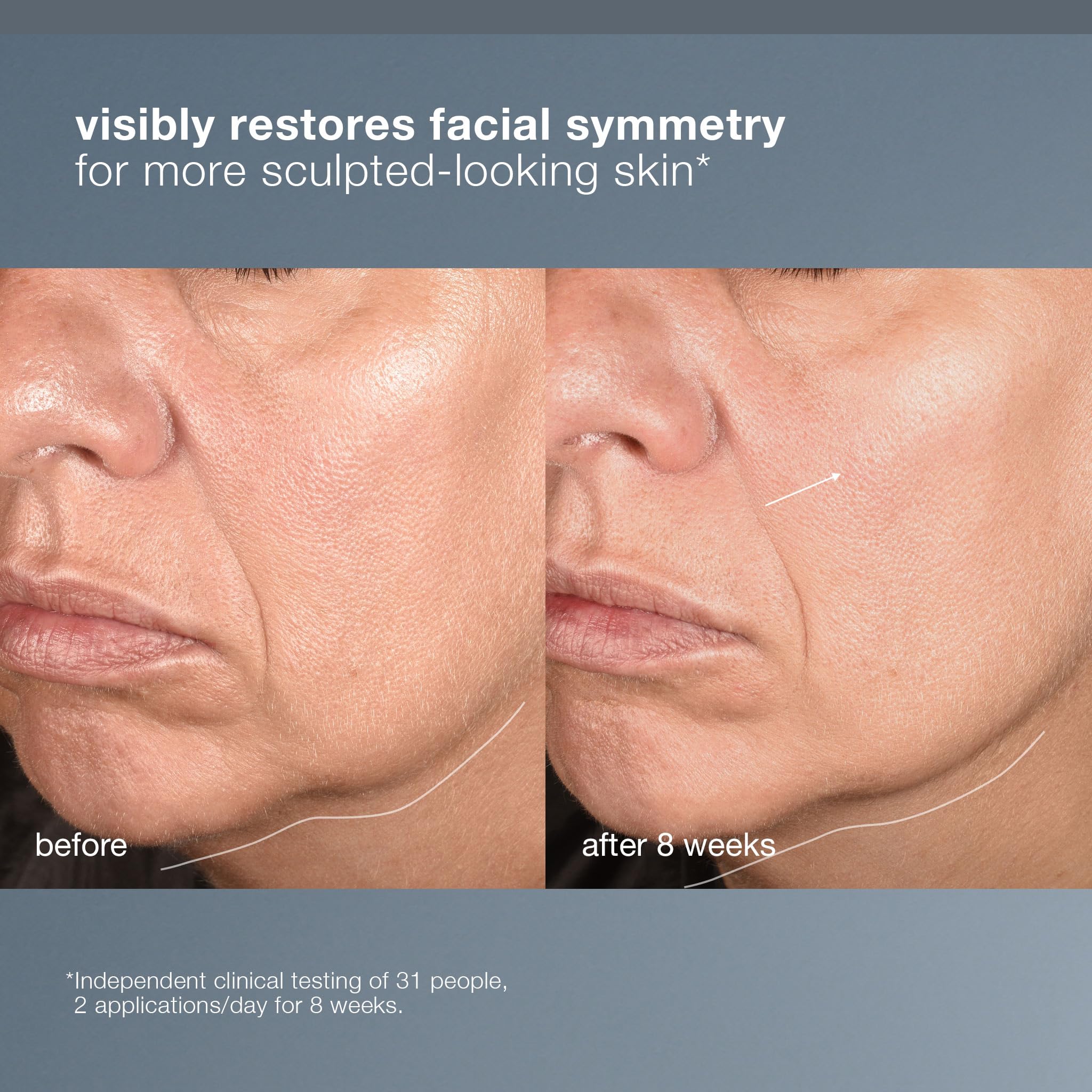 Dermalogica NeuroTouch Symmetry Serum, Facial Sculpting - Nourishing and Restoring Face Symmetry,1 fl oz