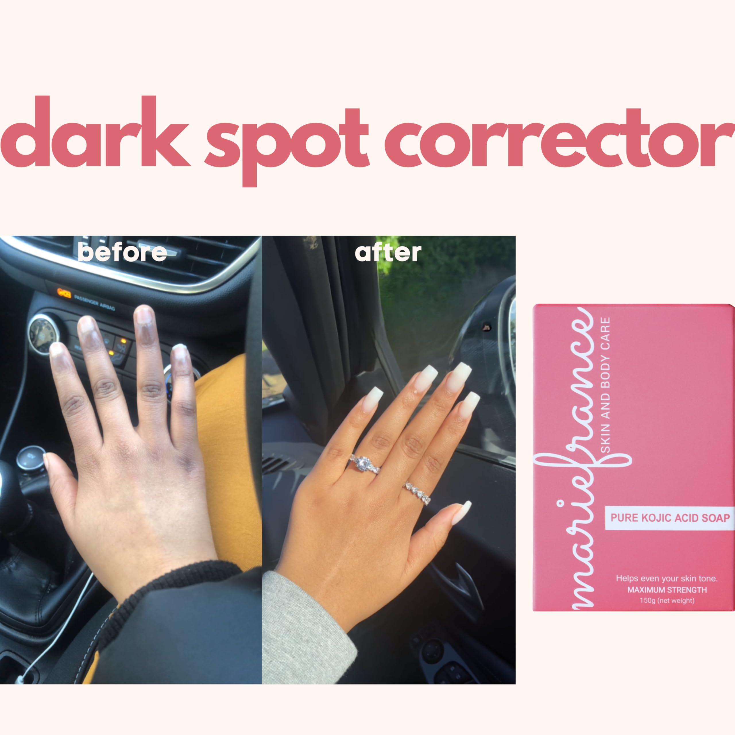 Pure Kojic Acid Soap for Hyperpigmentation, Dark Spots & Skin Brightening with Papaya Extract, Vitamin C & E - Maximum Strength, Fragrance-free, 5.3 oz