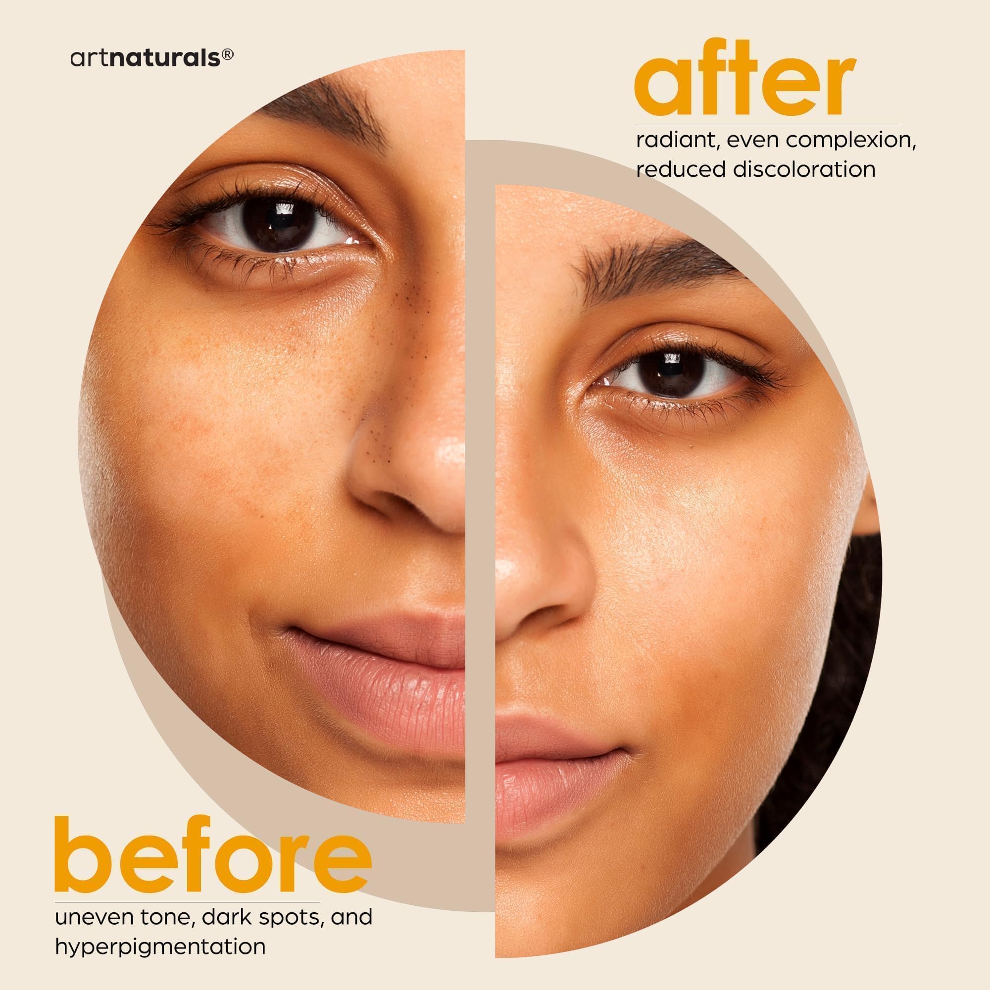 Kojic Acid Soap + African Net Sponge (2 pack X 142g Turmeric bars) Dark spot remover & Scars - Original Japanese Complex Vitamin C, Hyaluronic Acid, retinol, shea butter (Citrus)