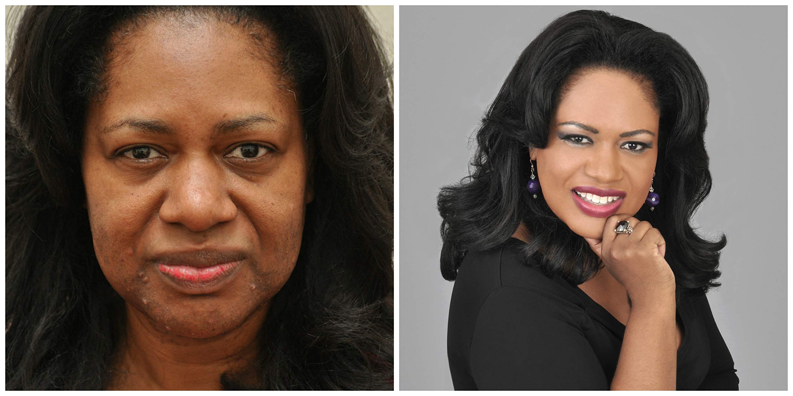 Killer Cover Full Coverage Concealer Makeup - Cover Bruises