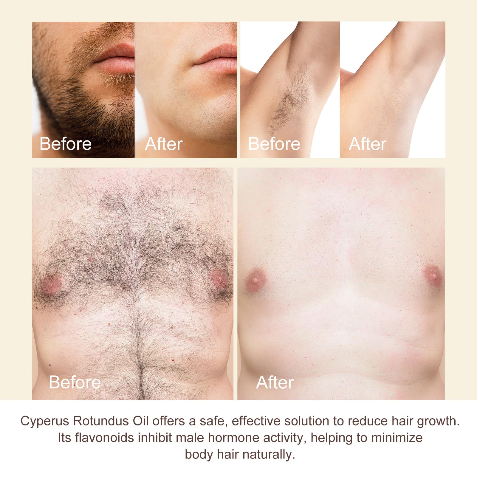 Cyperus Rotundus Oil, Pure Cyperus Oil,Cyprus Rotundus Oil for Hair Removal, Cyprus Oil Natural Nut Grass Oil for Reducing Body Hair Growth, Smooth Skin, Moisturizing & Soothing (Pack of 2-4.04 FL.OZ)