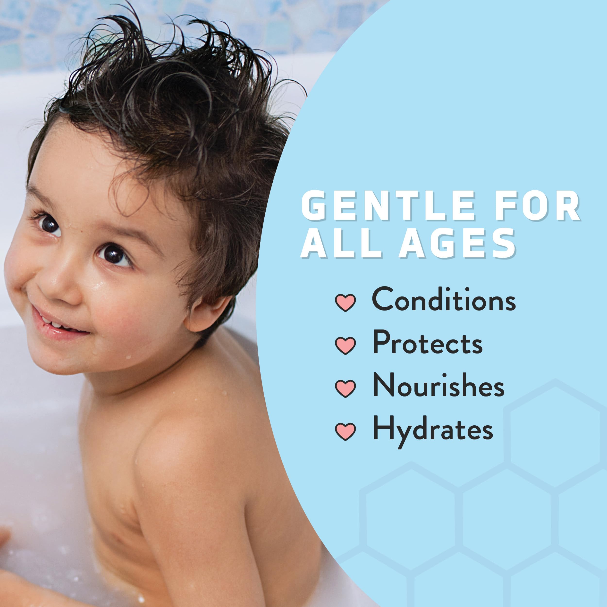 PSORIASIS HONEY Renewing Conditioner - Dry Scalp Treatment - Psoriasis Cream for Dry Hair - Coconut Oil Hair Moisturizer Helps Relieve Symptoms of Eczema, Dandruff, Dermatitis & More (8oz)