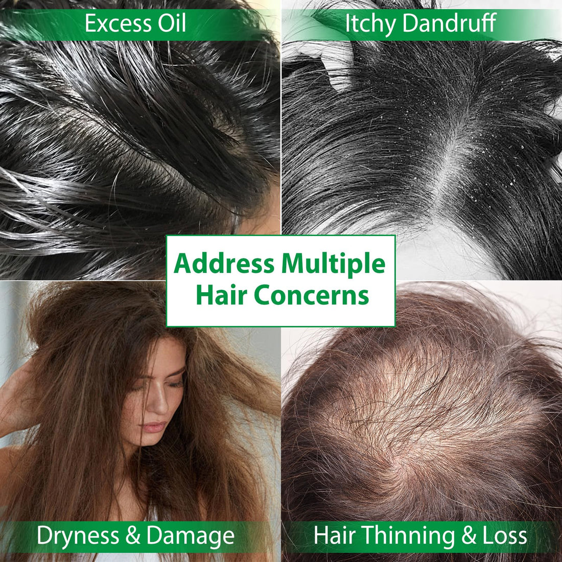 Batana Oil Hair Growth Shampoo and Conditioner Set Hair Loss Shampoo for Thinning Hair for Women and Men - Hydrates Dry Hair, Improves Scalp Health