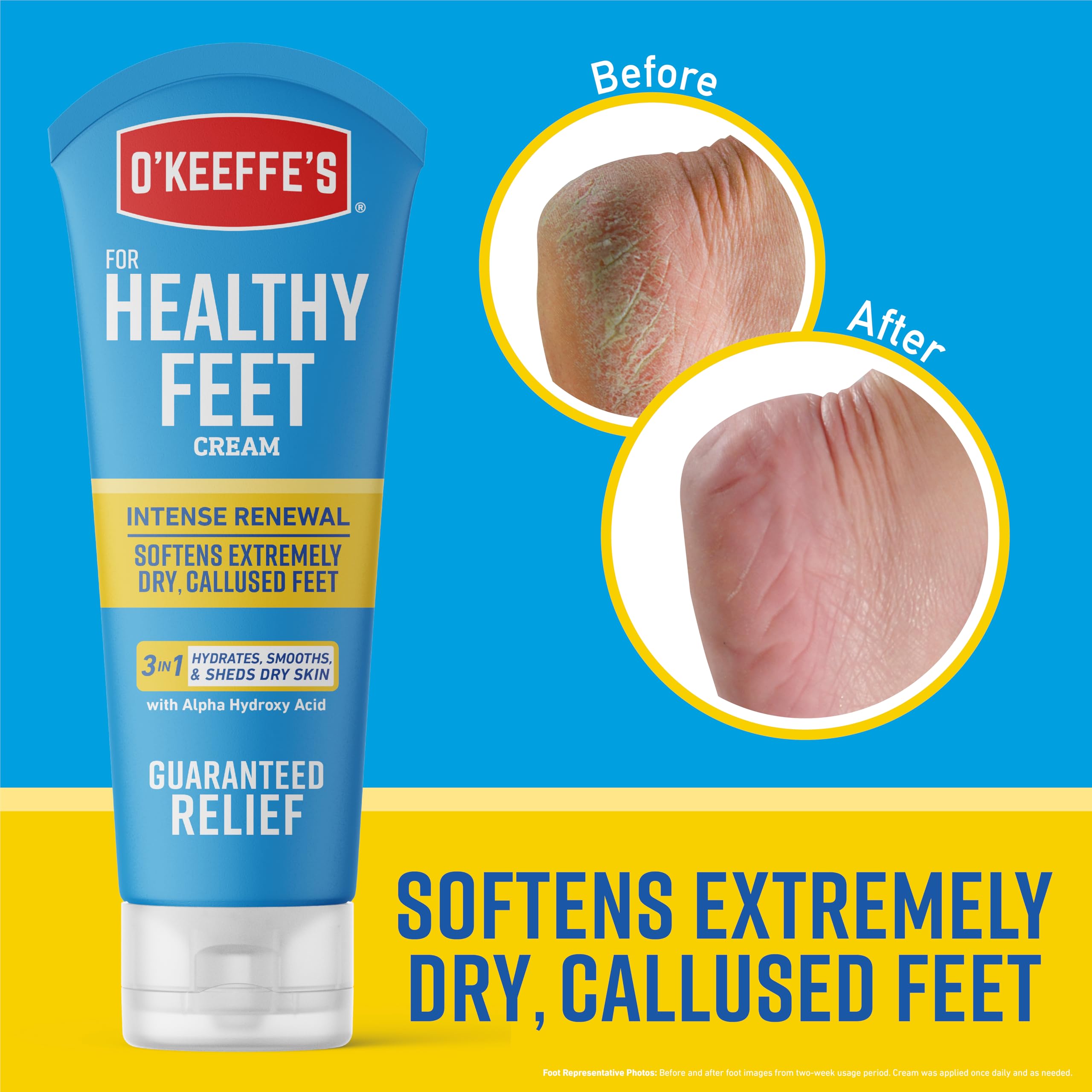 O'Keeffe's Healthy Feet Intense Renewal Cream with Alpha Hydroxy Acid; Softens and Exfoliates Extremely Dry; Callused Feet; 3oz Tube (Pack of 1)