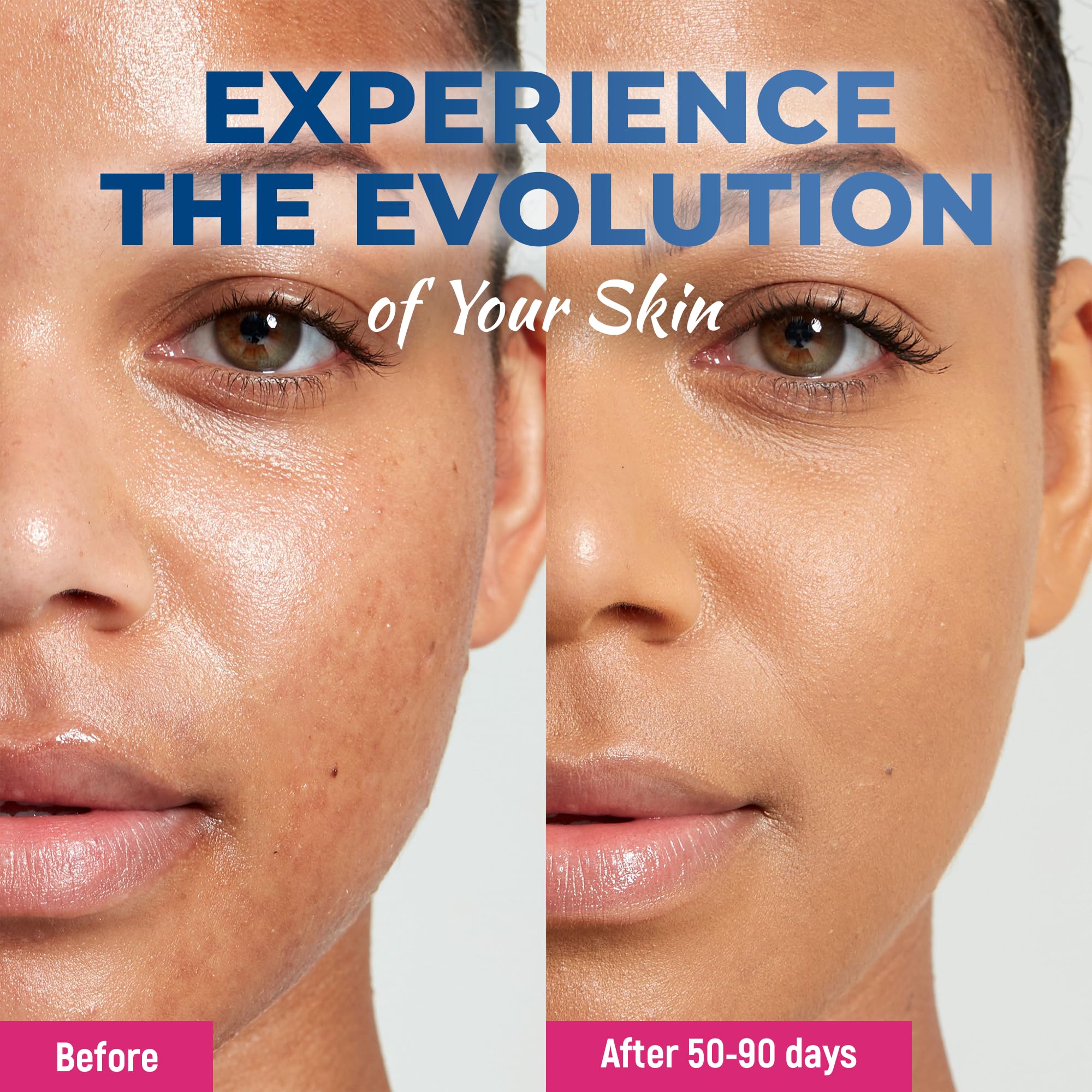 PENEBELLA Niacinamide Face Serum – Hydrating Facial Serum with Hyaluronic Acid – Skincare for Uneven Skin Tone