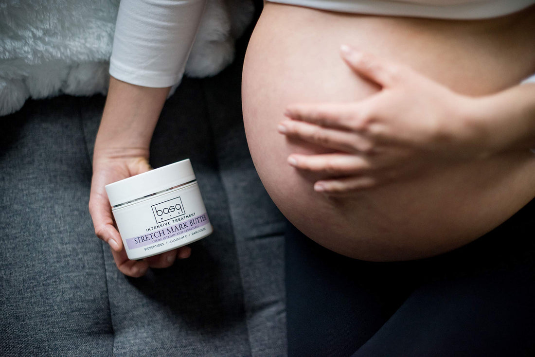 Intensive Treatment Stretch Mark Butter