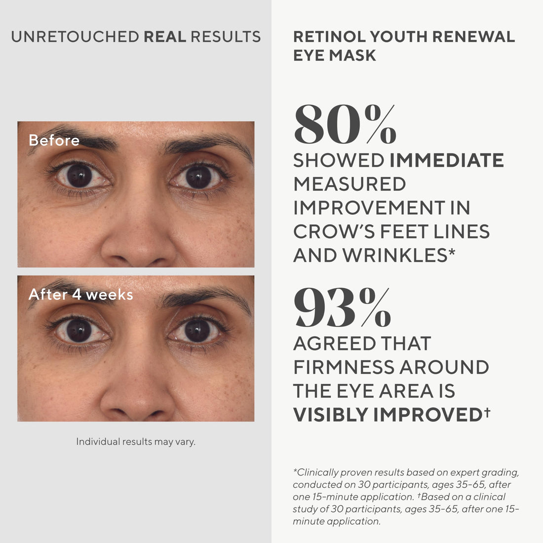 Murad Dr. Zion Retinol Youth Renewal Eye Masks – No-Slip Under Eye Patches for Fine Lines, Wrinkles, Crow’s Feet and Puffy Eyes - Full Absorption Treatment Strips, 5 Pairs