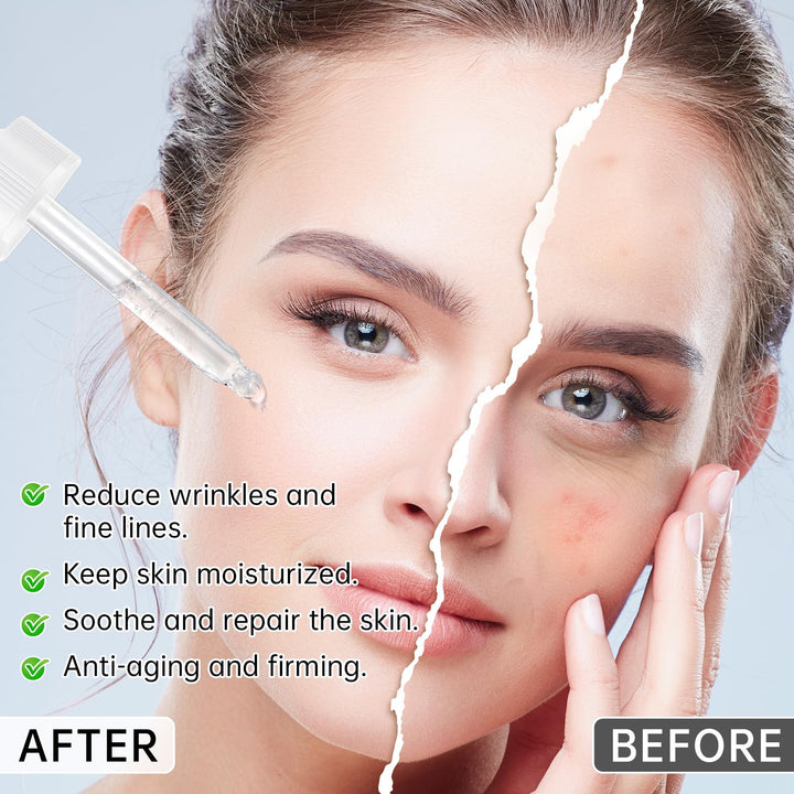 Anti Aging Argireline Solution 10%,Anti Wrinkle Hydrating Argireline Serum with Centella & Hyaluronic Acid for Skin Barrier Repair,30ml Peptides Serum for Face Reduce Fine Lines