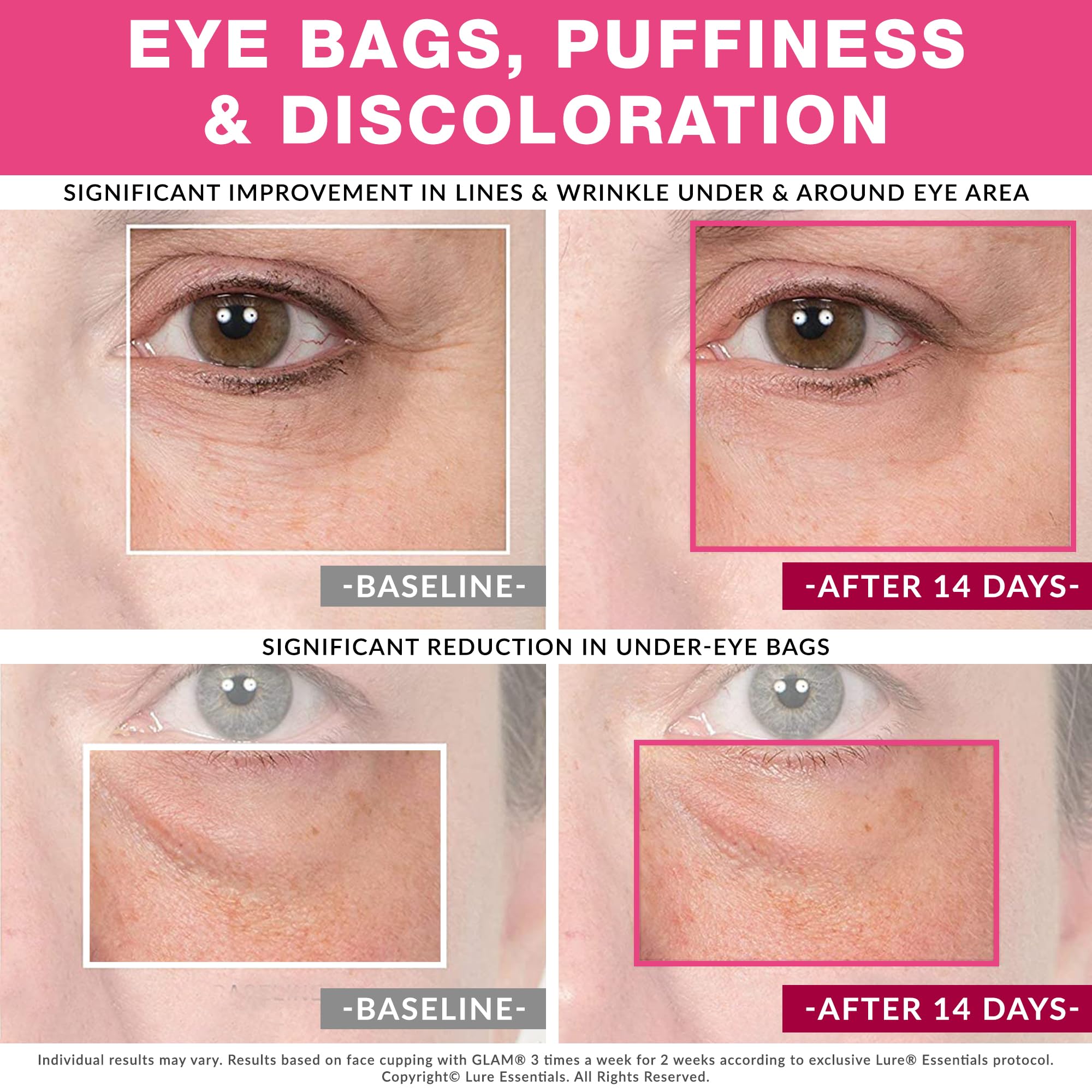 Best Face And Eye Cupping Massage Set Plus Free Brush For Face, Eye, Neck And Decollete New Original Anti Slip Design Professional Grade Anti Aging, Use With Oil Or Cream