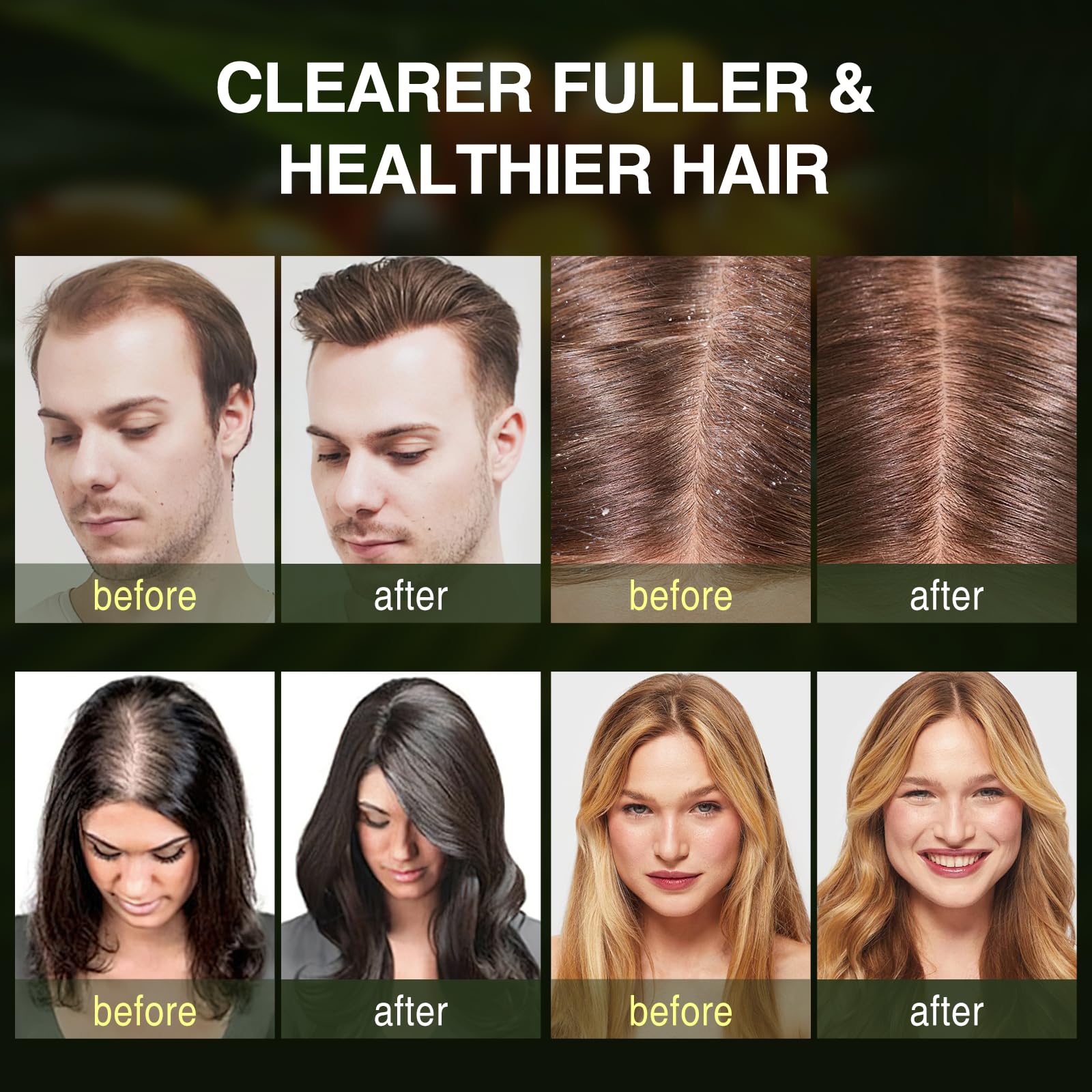 Batana Oil Hair Growth Shampoo, Thinning Hair & Hair Loss Shampoo with Rosemary & Tea Tree Oil, Strengthening & Thickening Formula for Women & Men, for All Hair Types, Sulfate Free, 10.15 fl oz