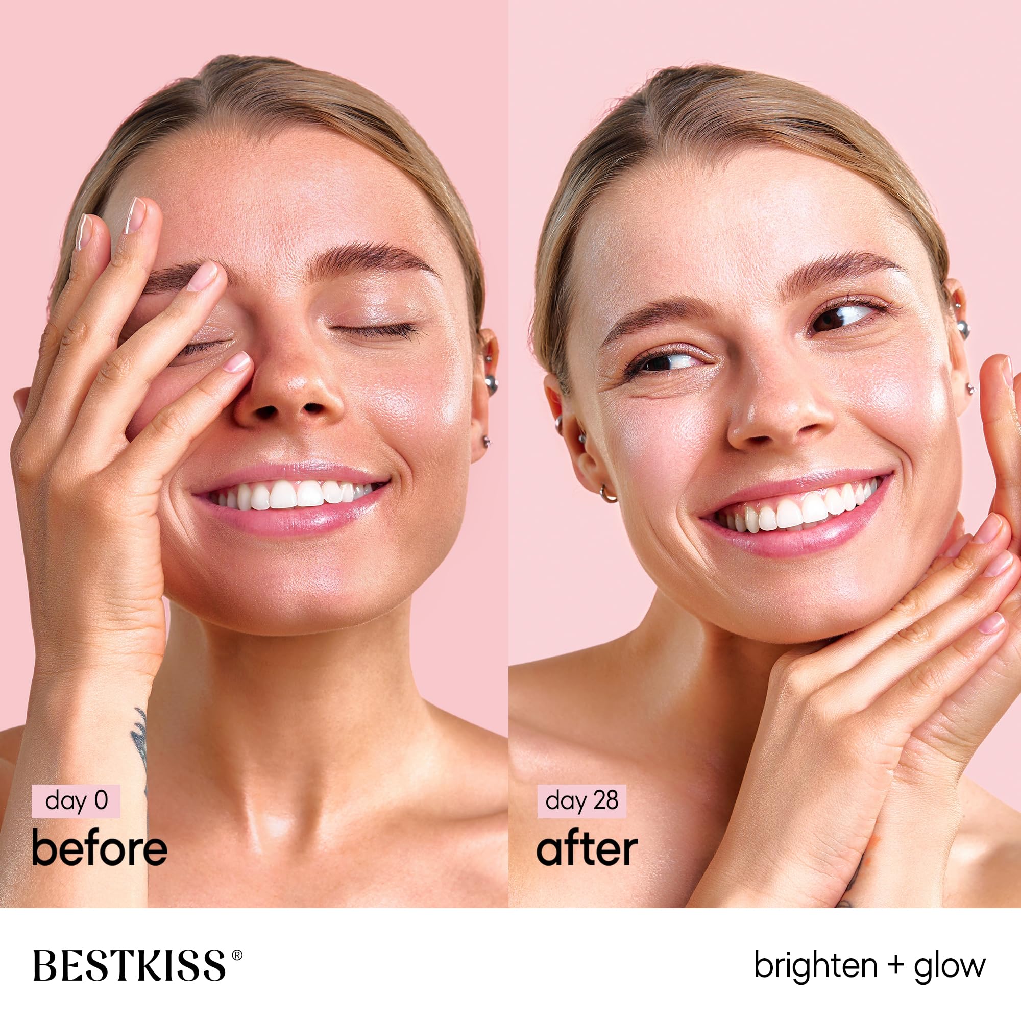 Bestkiss Dark Spot Remover for Face: 3% Watermelon 3% Niacinamide 5% Witch Hazel Dark Spot Correcting Glow Serum with Aloe Vera Centella Asiatica Hyaluronic Acid - Paraben Fragrance Cruelty Free 30mL