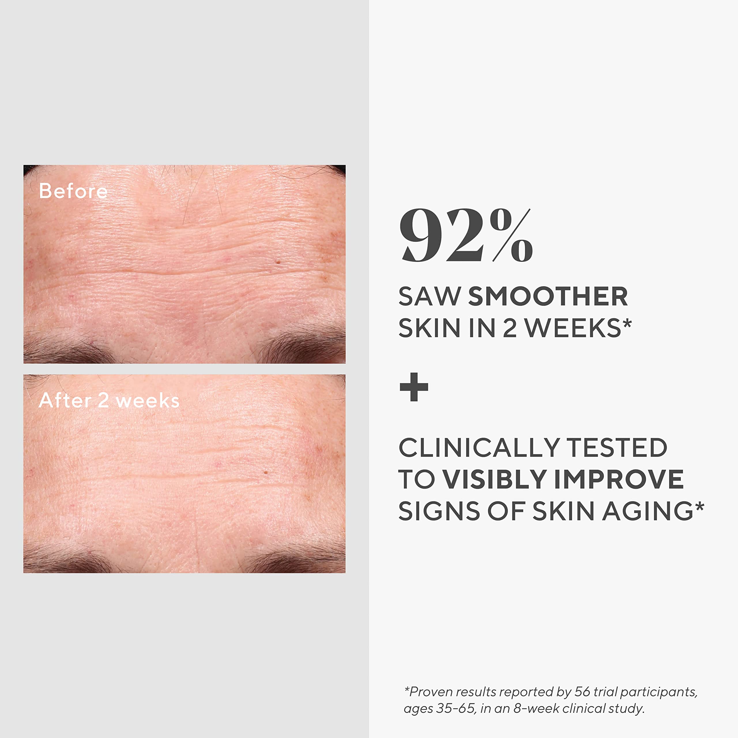 Murad Retinol Youth Renewal Serum, 1 Ounce by Murad