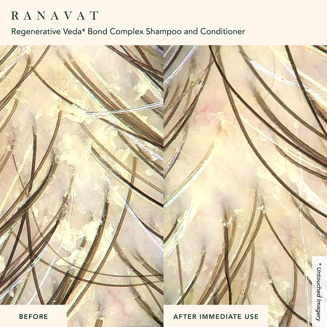 RANAVAT BOTANICS RANAVAT Bond Repair Hair Conditioner - Moisturizing Conditioner for Hair Breakage Repair & Scalp Care - Silicone-Free Volumizing Conditioner for All Hair Types (8 oz)