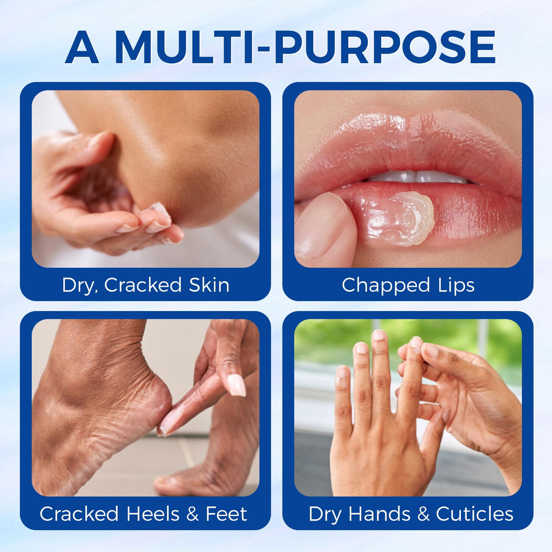 OUKEYA Healing Ointment, Advanced Therapy Skin Protectant, Multi-Purpose Healing Ointment and Body Moisturizer, For Dry, Cracked Skin, Minor Cuts and Burns, Soothes Cracked Hands and Chapped Lips