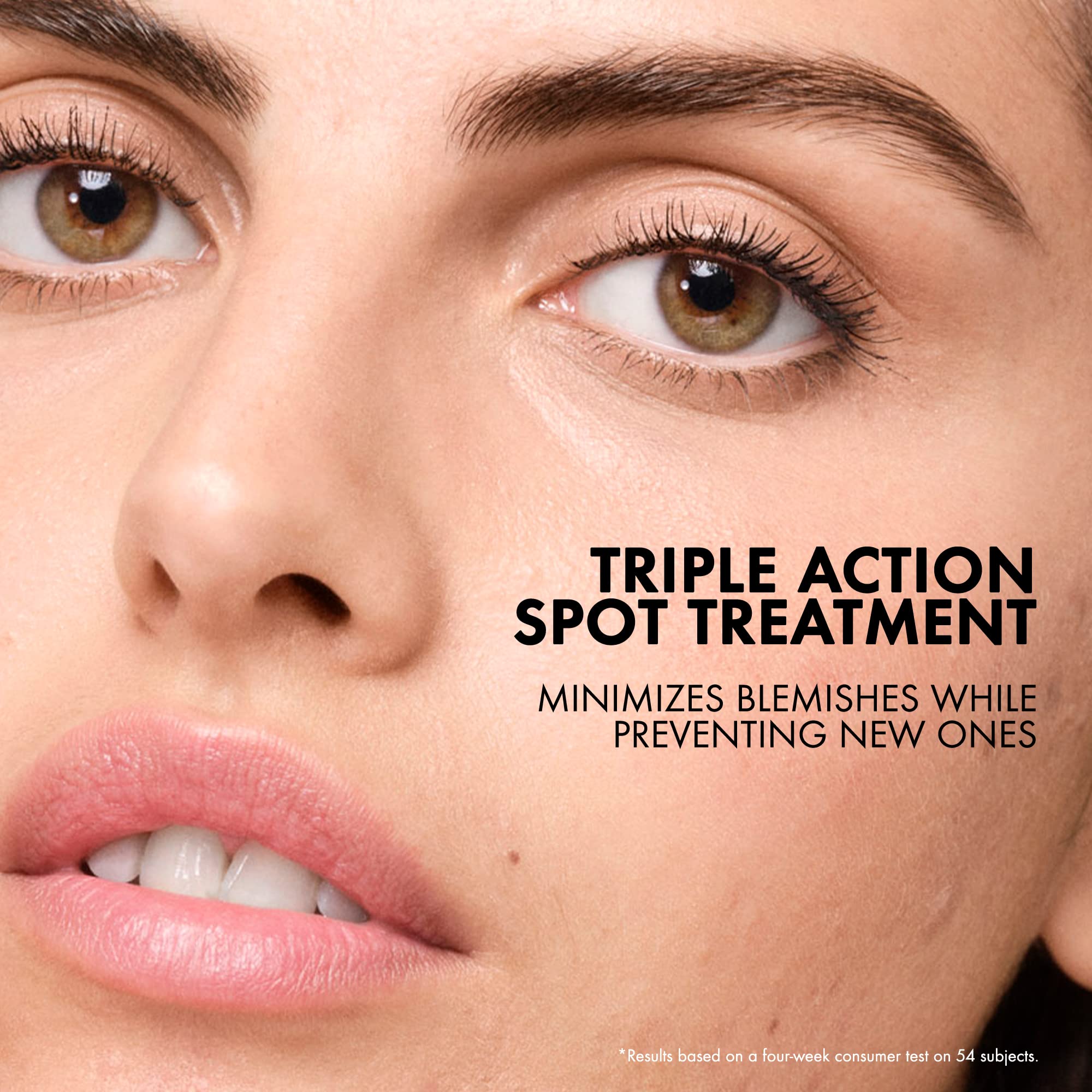 Vichy Normaderm S.O.S Acne Rescue Spot Corrector, Acne Spot Treatment for Face with 10% Sulfur, Niacinamide & Glycolic Acid, Suitable for Sensitive Skin