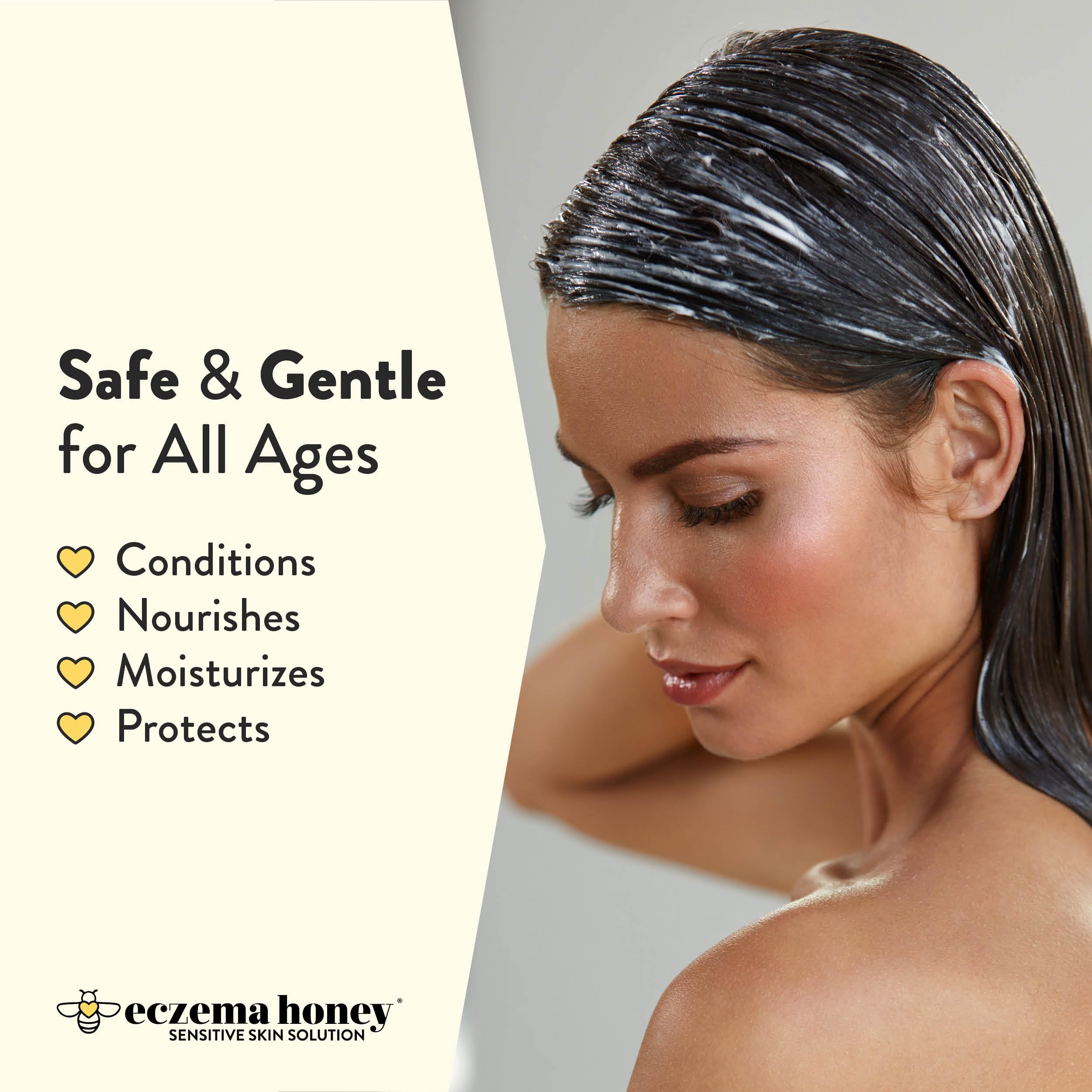 ECZEMA HONEY Nourishing Conditioner - Helps with Psoriasis, Dermatitis, & Flaking - Daily Dandruff Conditioner & Scalp Care - Itchy Scalp Treatment for Men, Women & Kids (8 Oz)