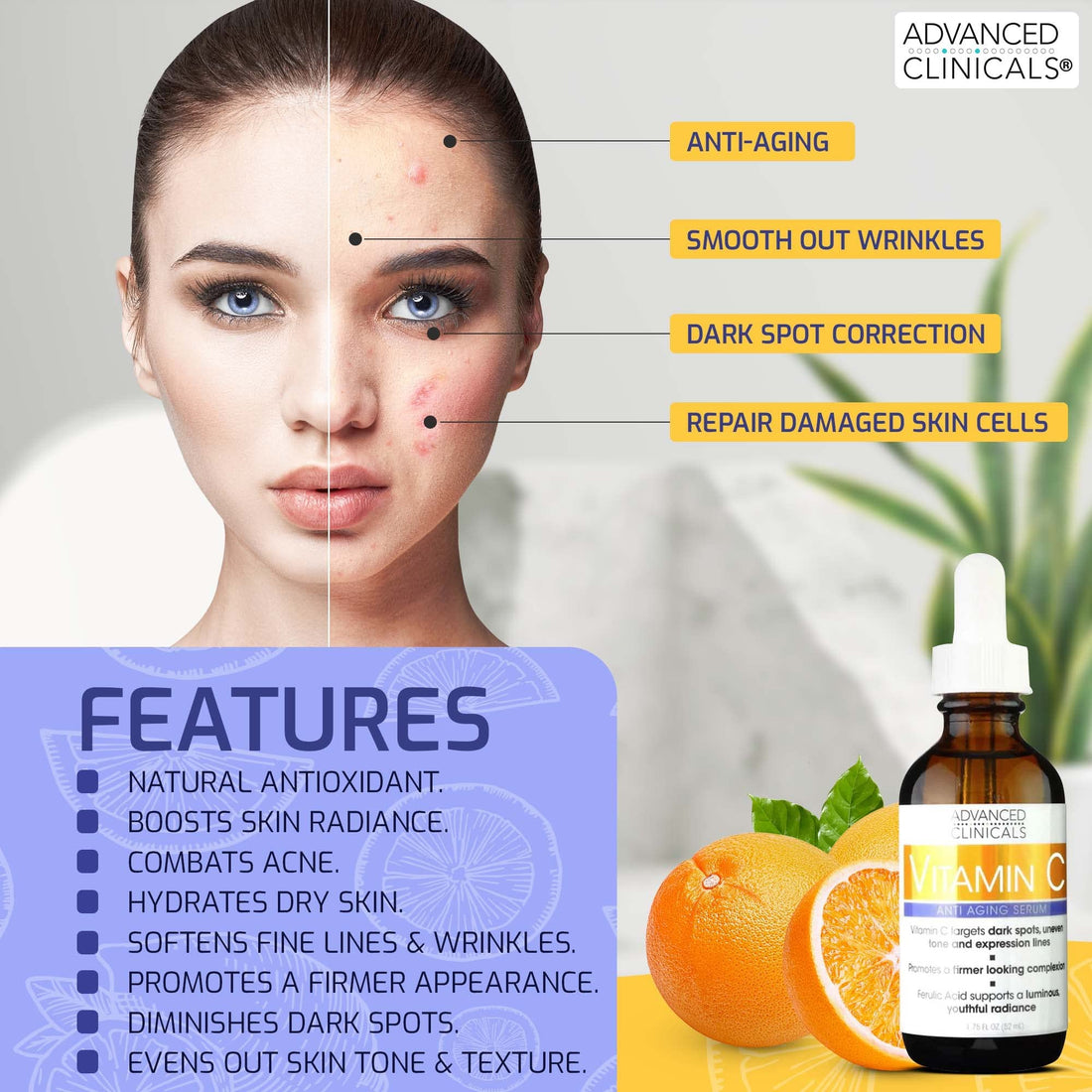 Advanced Clinicals Vitamin C Facial Serum Skin Care Anti-Aging Moisturizer Potent Vitamin C Face Lotion For Dry Skin, Age Spots, Wrinkle Repair, & Uneven Skin Tone, 1.75 Fl Oz (Pack of 2)