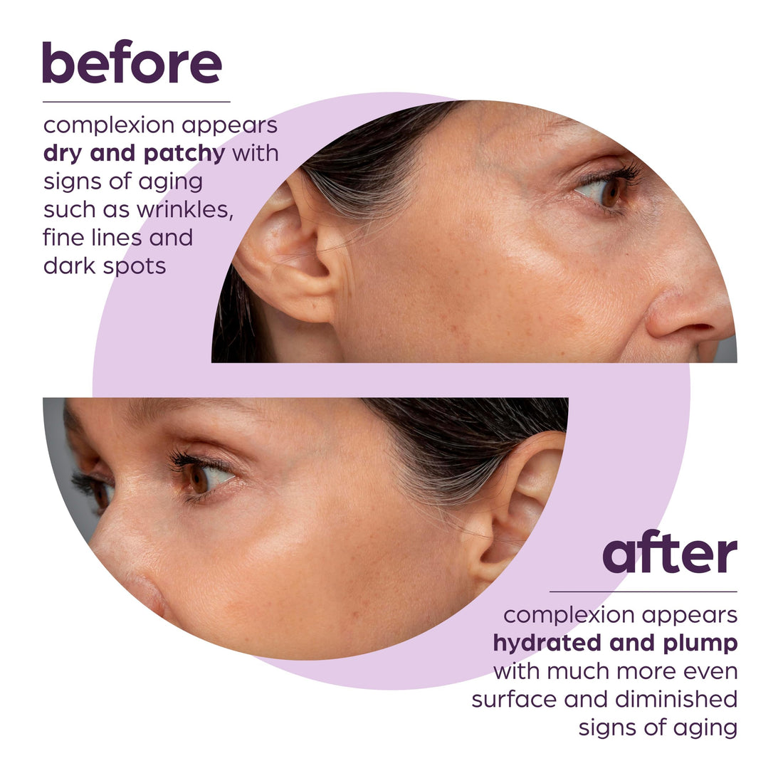 50% Beta Glucan Serum | Anti-Aging, Hydrating & Plumping for Dry Skin, Fine Lines, Wrinkles, Dark Spots | Niacinamide, Centella, Hyaluronic Acid | Korean Skincare | Lightweight, Non-Greasy