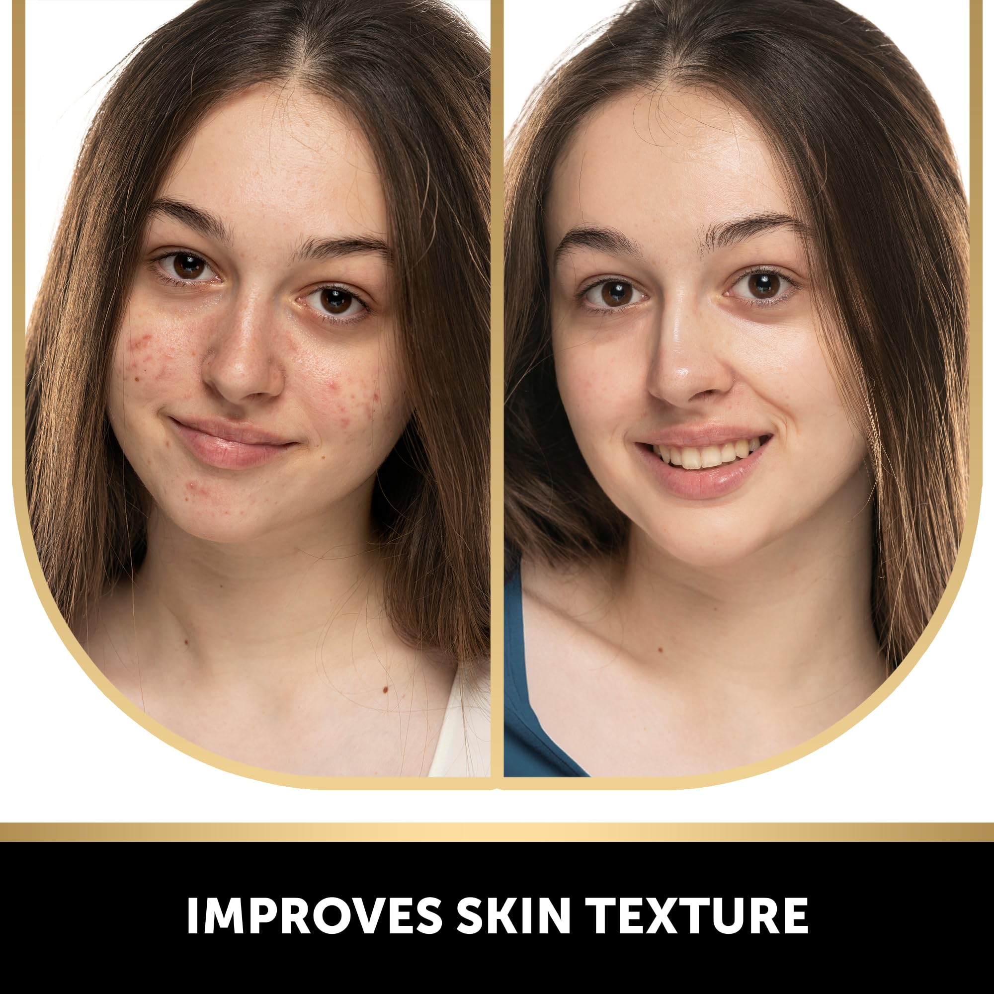 VALITIC Salicylic Acid and Vitamin C Soap Bar - Facial Cleanser and Exfoliating Body Wash for Blackheads, Enlarged Pores and Blemish Skin with Collagen, Hyaluronic Acid, Vitamin E - 2 Pack