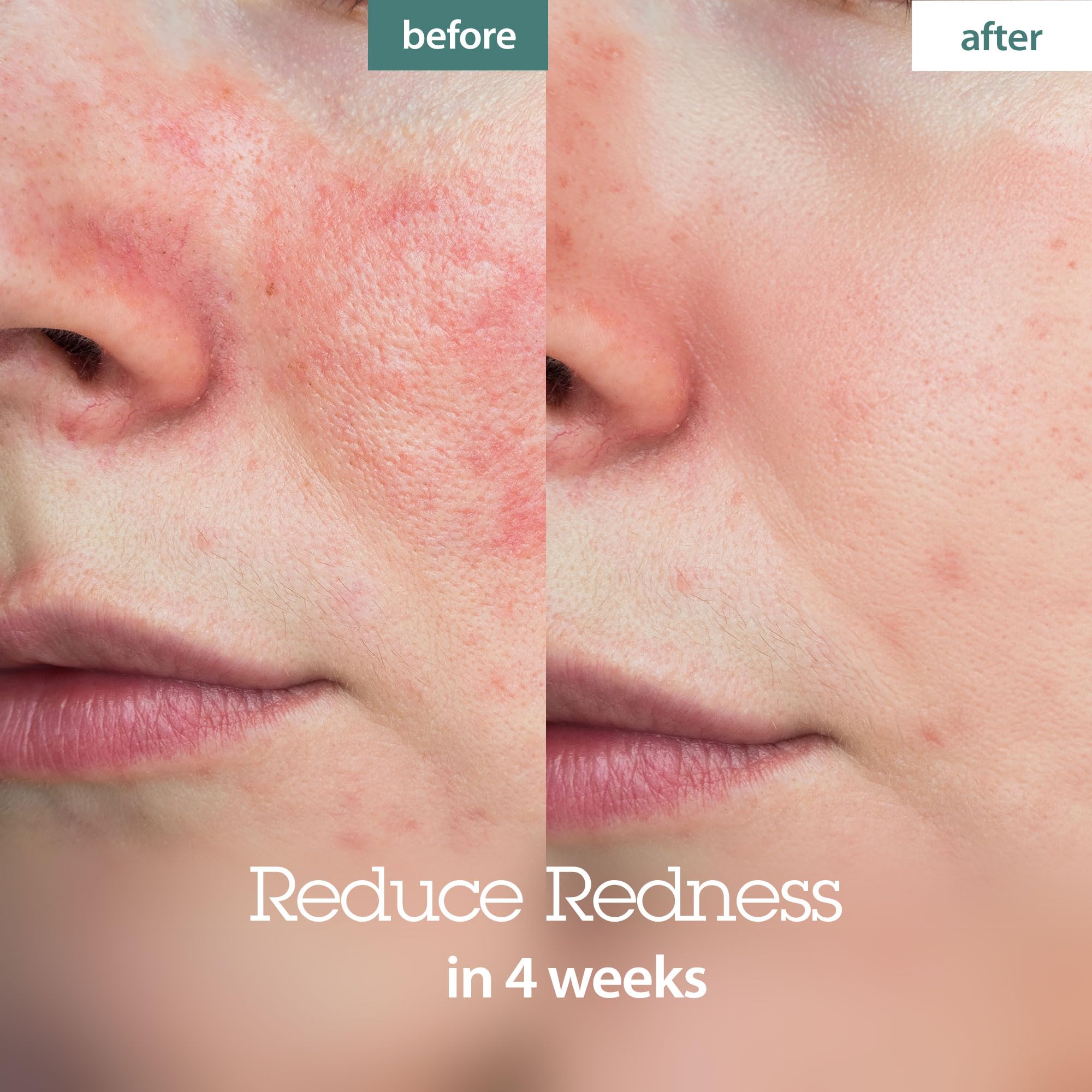 Blithe Pressed Serum Crystal Iceplant Cooling Eucalyptus Cream - Water Gel Face Moisturizer for Combination Skin with Mistletoe Evening Primrose, Korean Clean Beauty Calming & Hydrating 1.68 Fl Oz