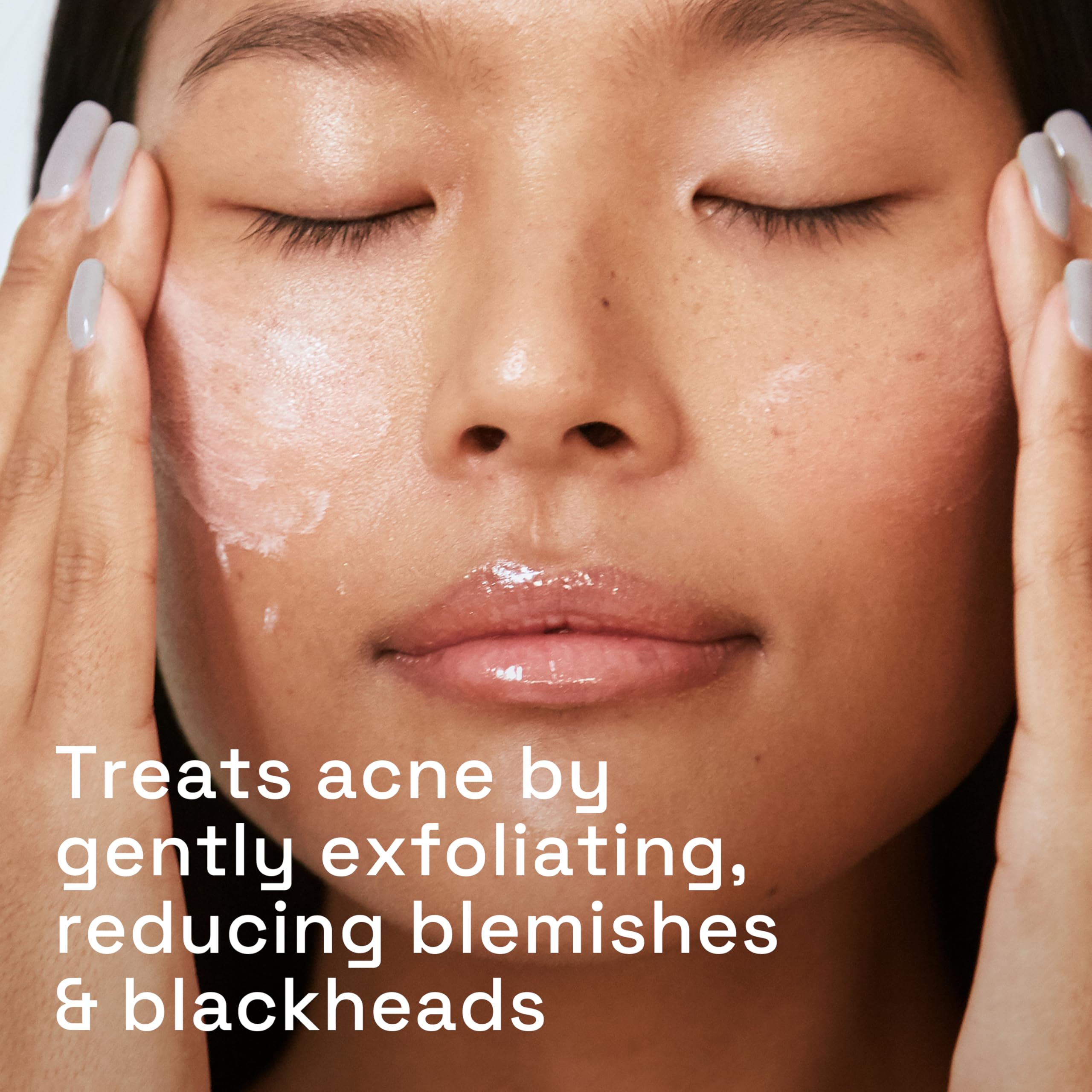 Cetaphil Gentle Clear Pore Clearing Acne Cleanser, Foaming Gel Cleanser for Sensitive, Acne-Prone Skin, 8 Fl Oz Pump Bottle, 2% Salicylic Acid, Gently Exfoliates, Dermatologist Recommended Brand