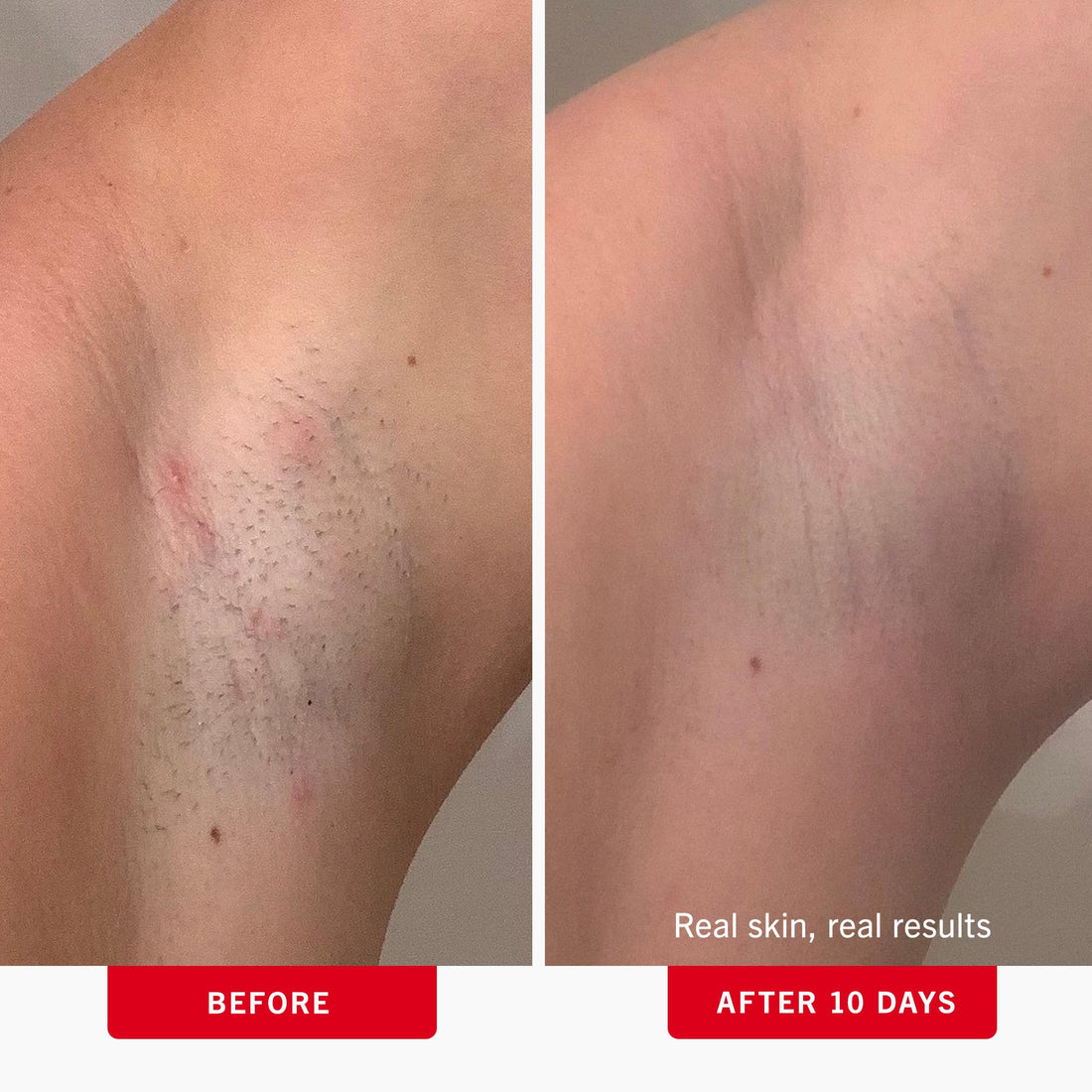 First Aid Beauty - Ingrown Hair Pads with BHA + AHA - Aftershave Treatment Pads to Help Prevent Razor Bumps for Men & Women - Exfoliate Underarms & Bikini Area - Compostable for Daily Use - 60 Pads