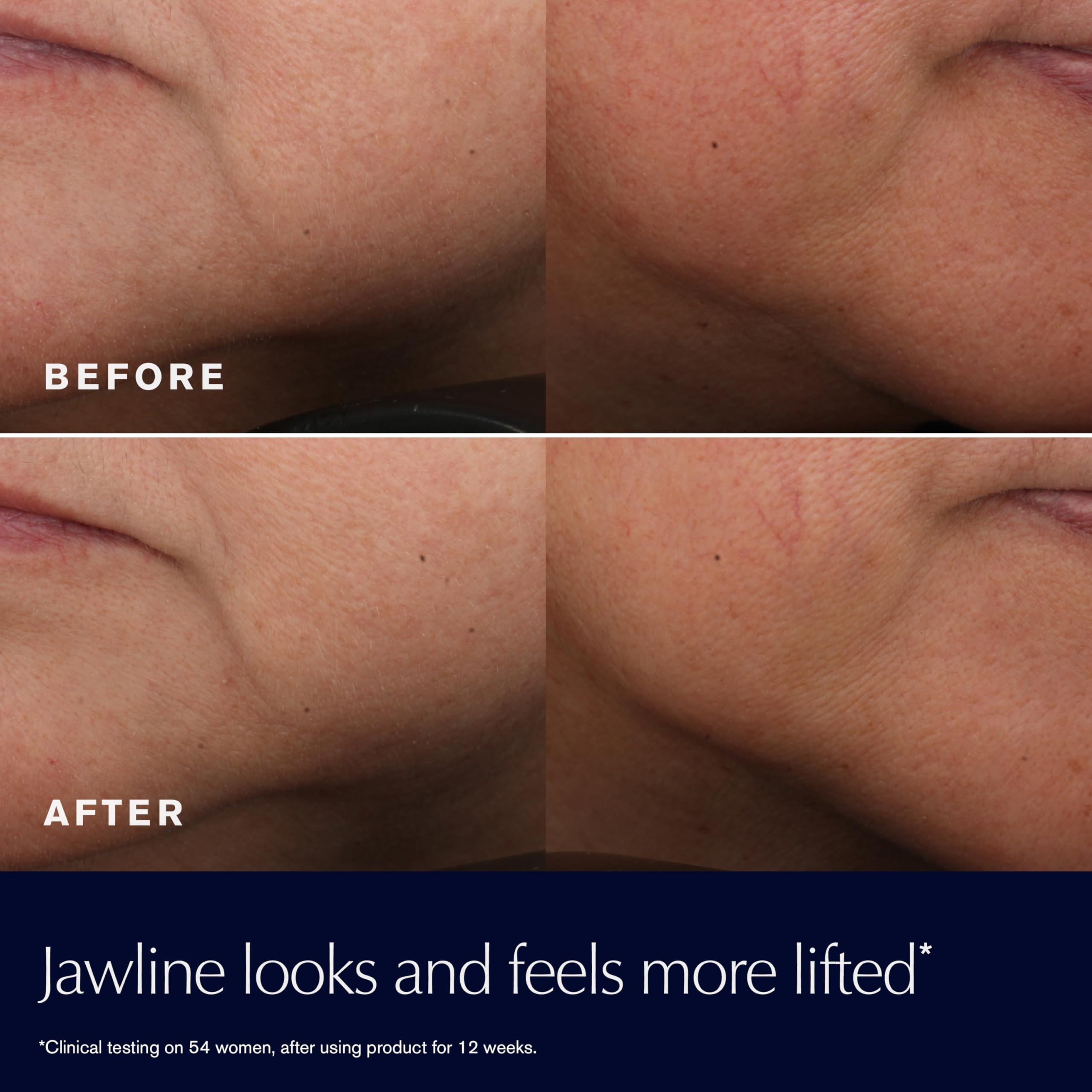 Estée Lauder Revitalizing Supreme+ Youth Power Cream | Face Moisturizer with Hyaluronic Acid & Peptides | Anti-Aging, 1.7 Ounce