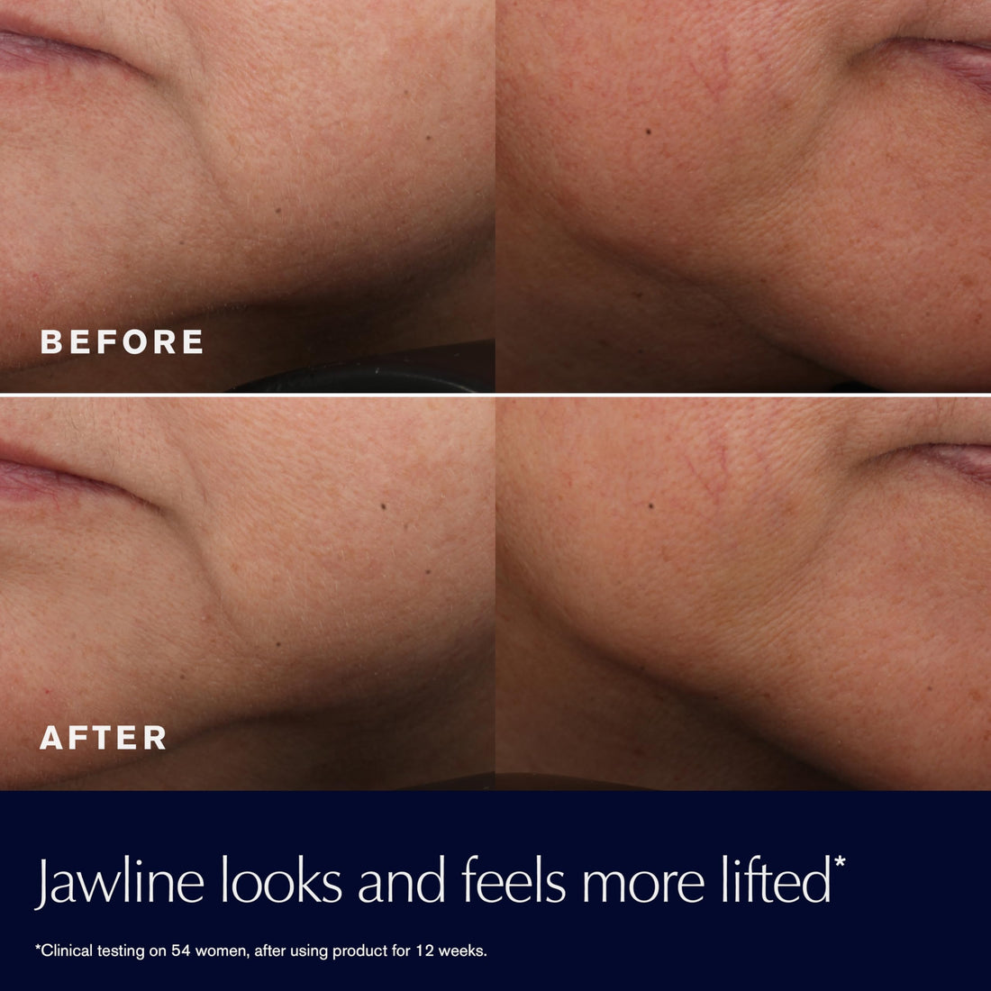 Estée Lauder Revitalizing Supreme+ Youth Power Cream | Face Moisturizer with Hyaluronic Acid & Peptides | Anti-Aging, 1 Ounce