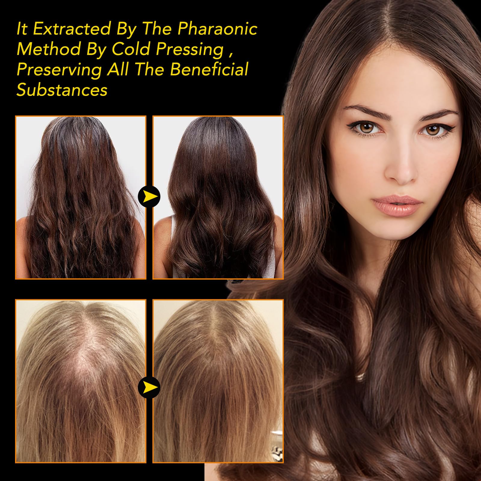 Black Seed Oil Organic Cold Pressed, 100% Pure and Natural Liquid, Enriched with High TQ & Dynamic Harmony of Omegas 3 6 9, Hair Growth, Skin Cares, Nourishes and Hydrates Hair