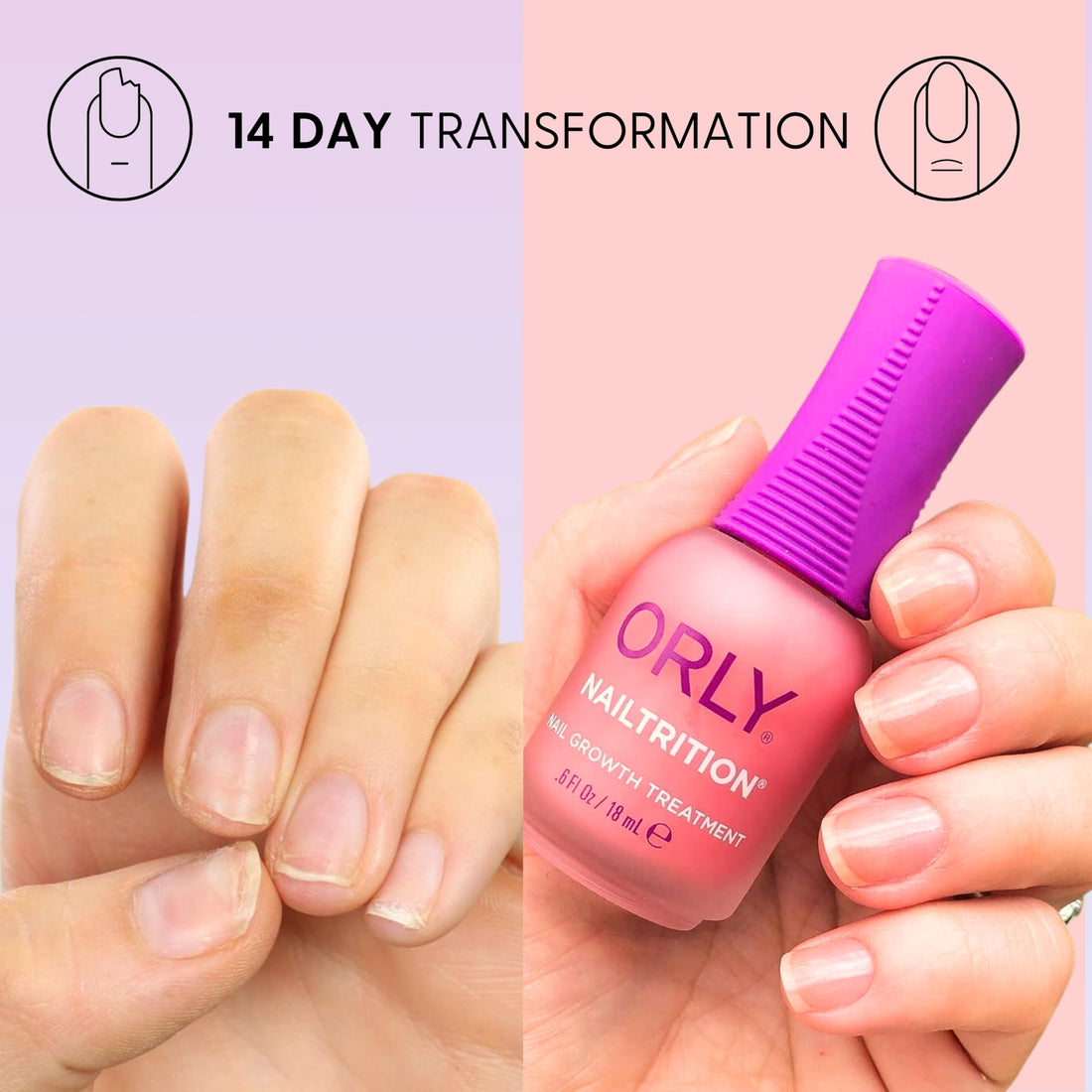 Orly Nailtrition Nail Strengthener, 18Ml, Yellow