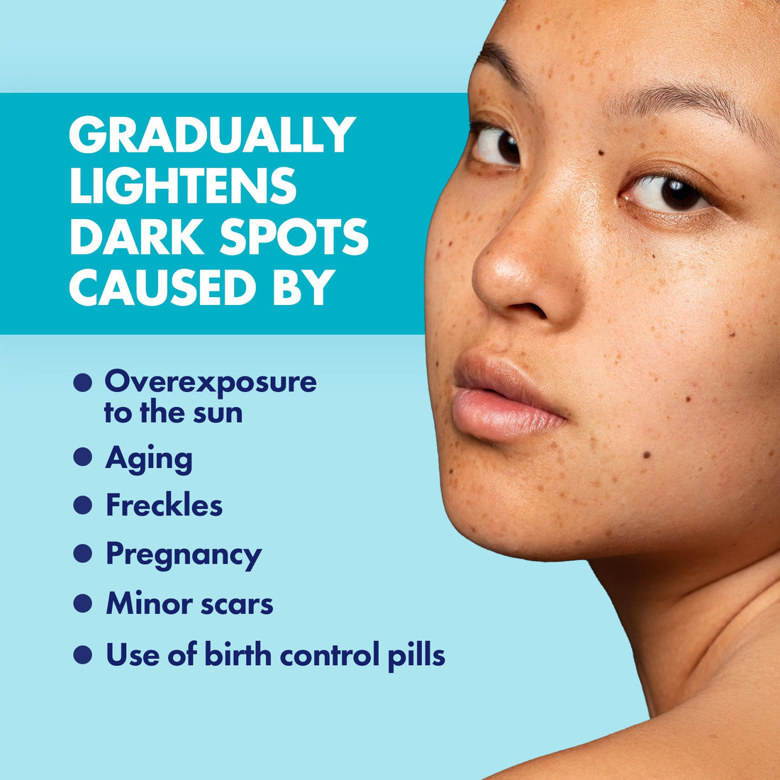 Dermisa Skin Fade Cream with Vitamin C | Helps Reduce Dark Spots and Age Spots | All Skin Types | 1.78 OZ | Pack of 1