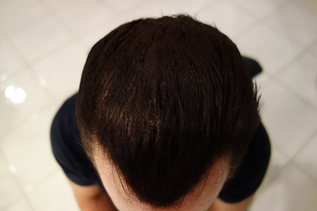Finally Hair Building Fiber Refill 100 Grams Dark Grey Hair Loss Concealing by Gray