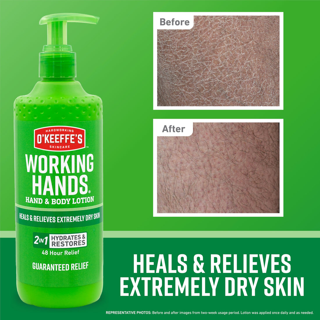 O'Keeffe's Hand and Body Lotion - 12 oz Pump (1 Pack) - Healing Lotion, Relieves Extremely Dry Skin