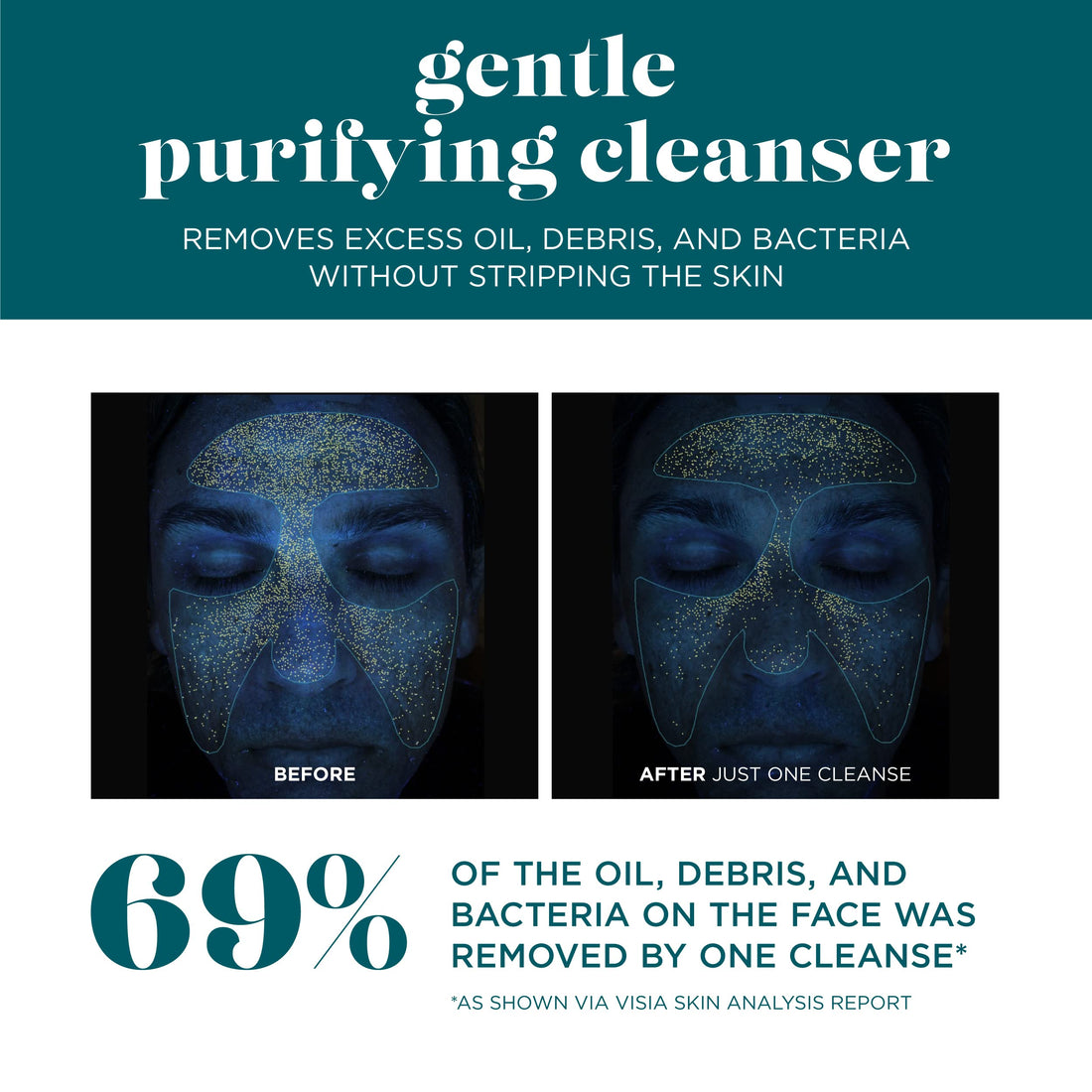 Vi Derm Cleanser, 8.0 Fluid Ounce