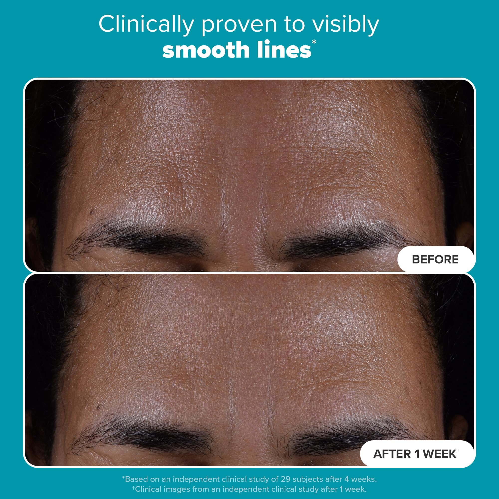 Paula's Choice SKIN PERFECTING 2% BHA Liquid Exfoliant, Salicylic Acid Exfoliant Toner Pads, Facial Exfoliator for Enlarged Pores, Wrinkles & Fine Lines and Suitable for Blackhead-Prone Skin, 10 ct