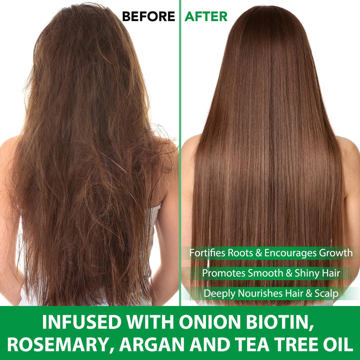 Batana Oil Shampoo and Conditioner Set, Raw Batana Oil for Hair Growth Shampoo and Conditioner with Biotin, Routine Shampoo and Conditioner for Women Men Hair Loss and Thinning, 2x10.56 Fl Oz