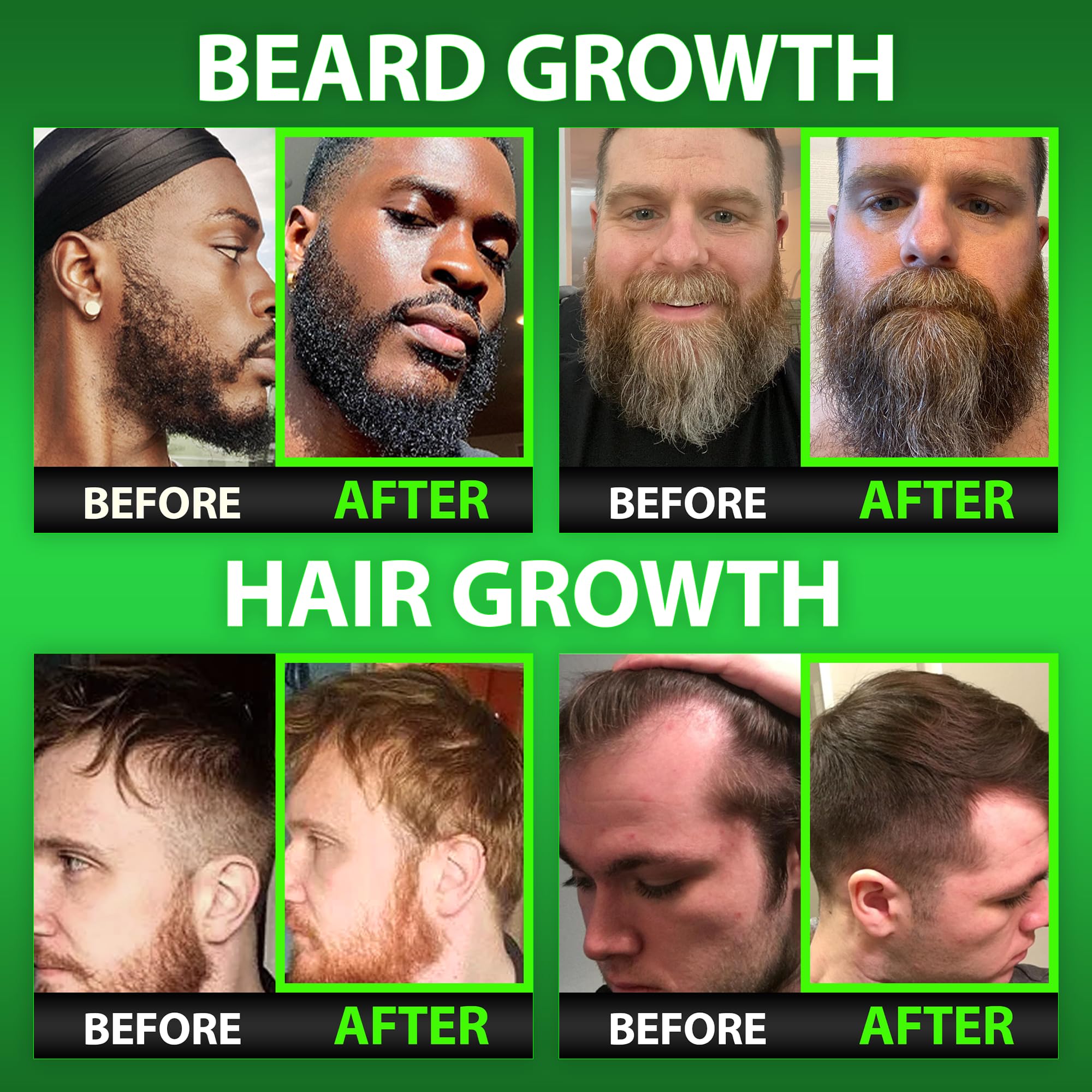 BBS Beard Growth & Hair Growth Vitamins for Men - Maximum Strength 620000mcg Biotin - Collagen - MSM - Keratin - Bamboo Extract - Multivitamin Gummies (Made by Best Beard Stuff USA)