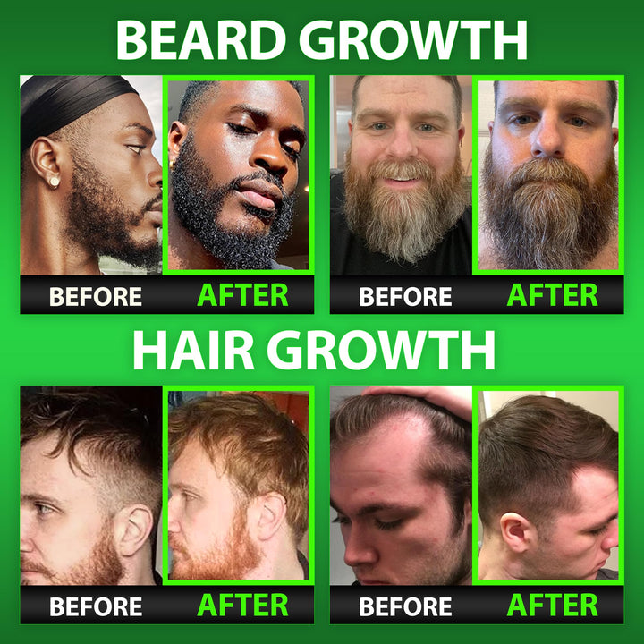 BBS Beard Growth & Hair Growth Vitamins for Men - Maximum Strength 620000mcg Biotin - Collagen - MSM - Keratin - Bamboo Extract - Multivitamin Gummies (Made by Best Beard Stuff USA)