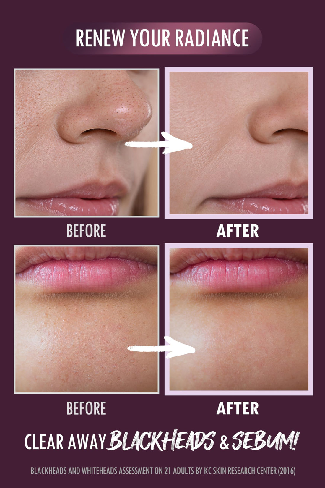 NEOGEN Pore Tight Peeling Mousse